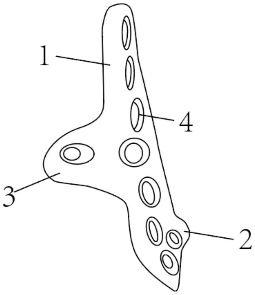 Hoffa anatomical steel plate