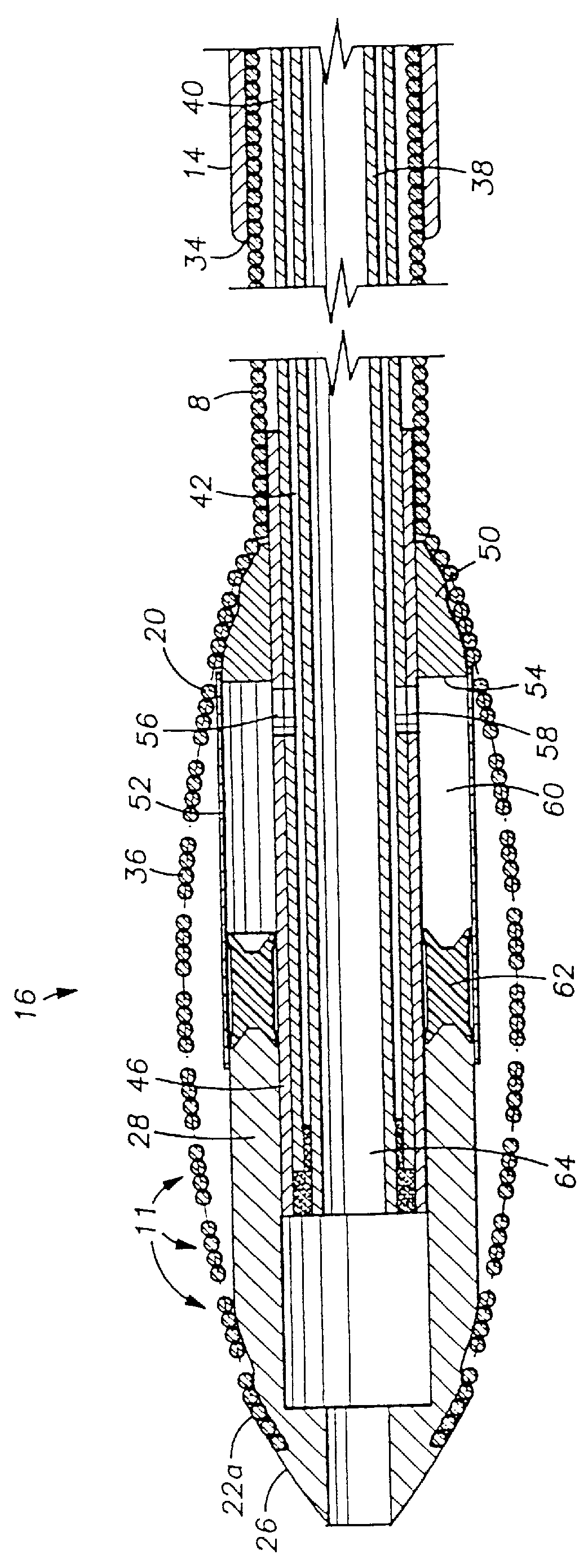 Expandable tip atherectomy method and apparatus