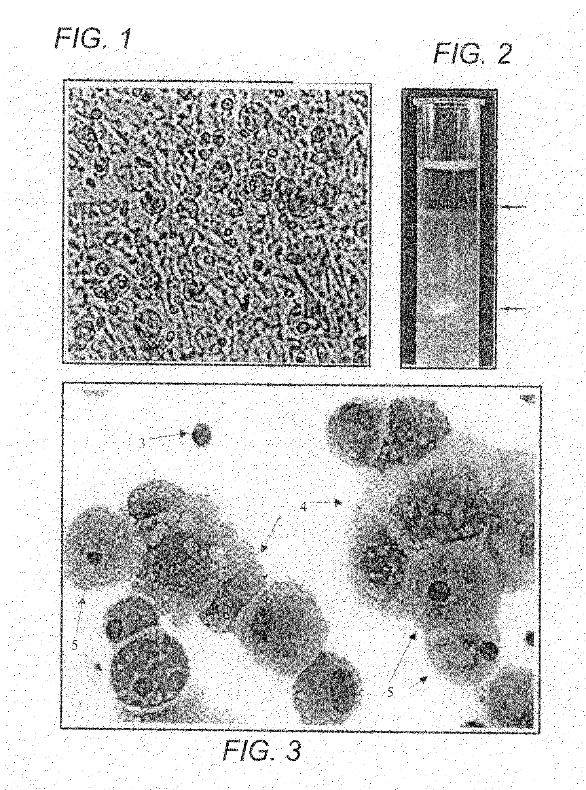 Method for preventing, or reducing the severity of, graft-versus-host disease using pluri-differentiated mesenchymal progenitor cells