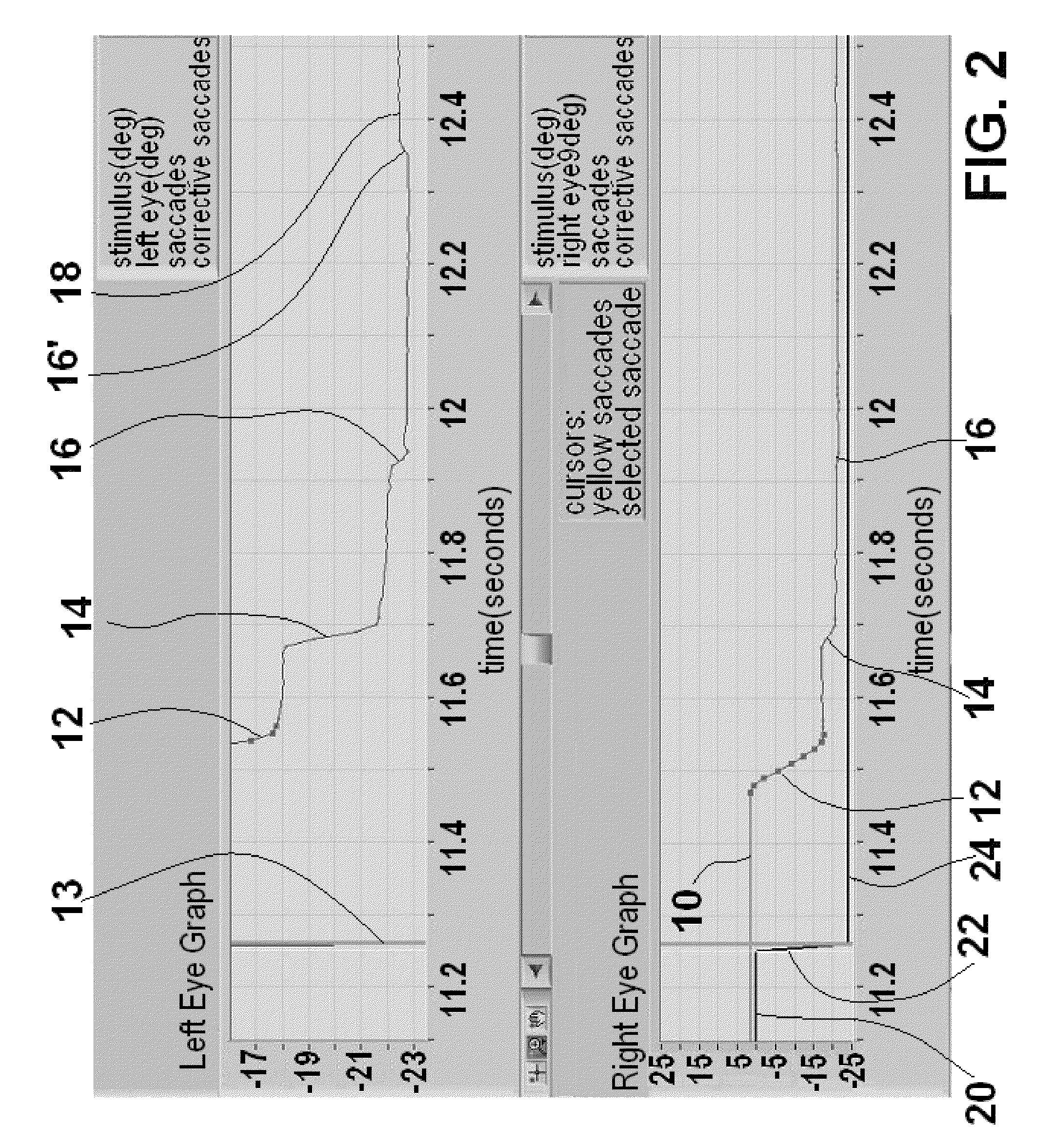 Method and apparatus for corrective secondary saccades analysis with video oculography system