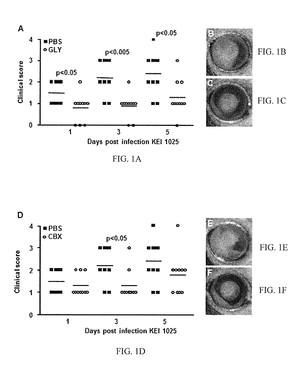 Compositions and methods relating to treatment of infection
