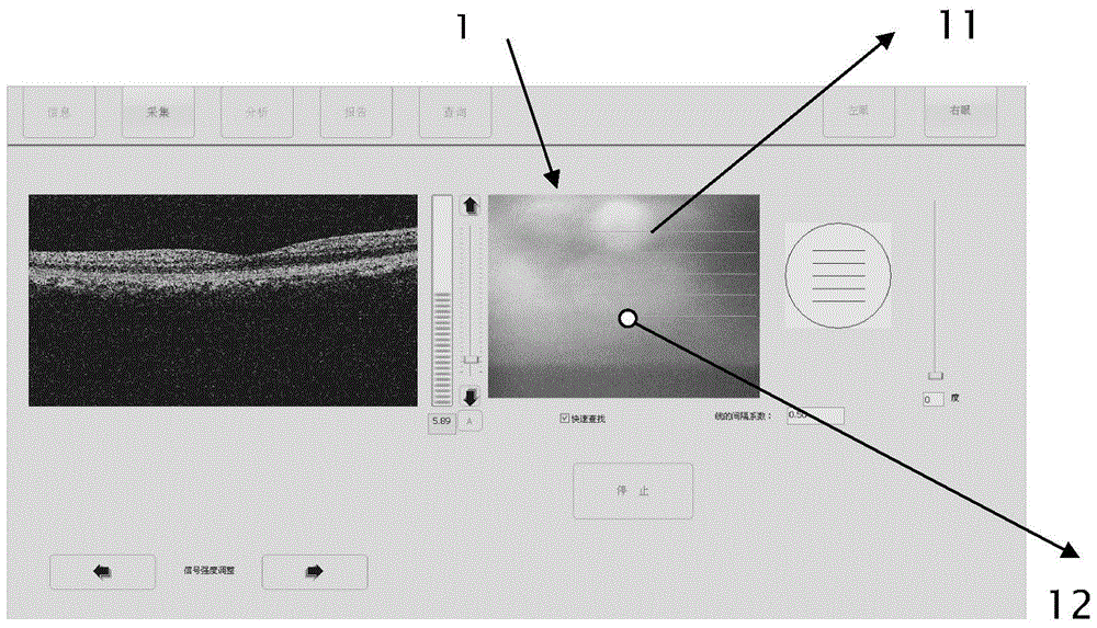 Detection method of retinal fixation point deviating from macular center