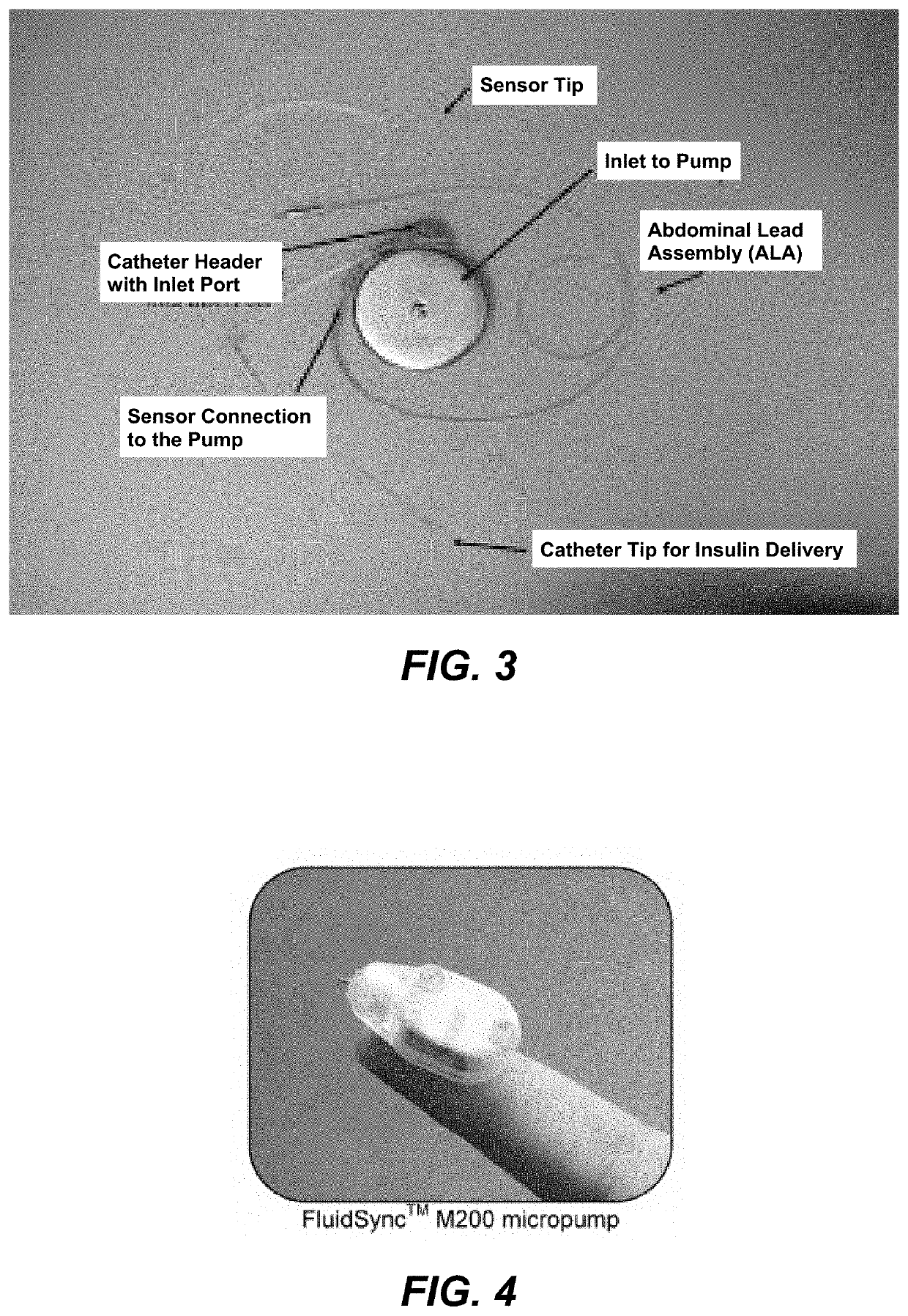 Tumor therapy