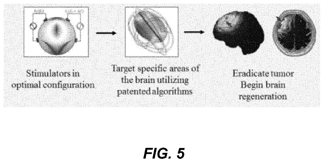 Tumor therapy