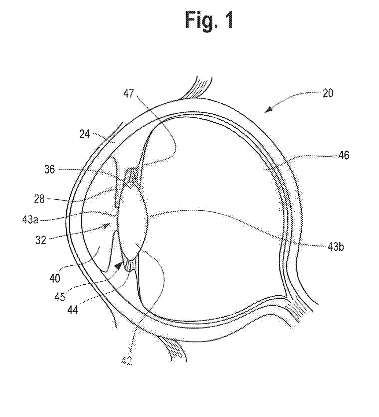 Intraocular lens and methods for implanting the same
