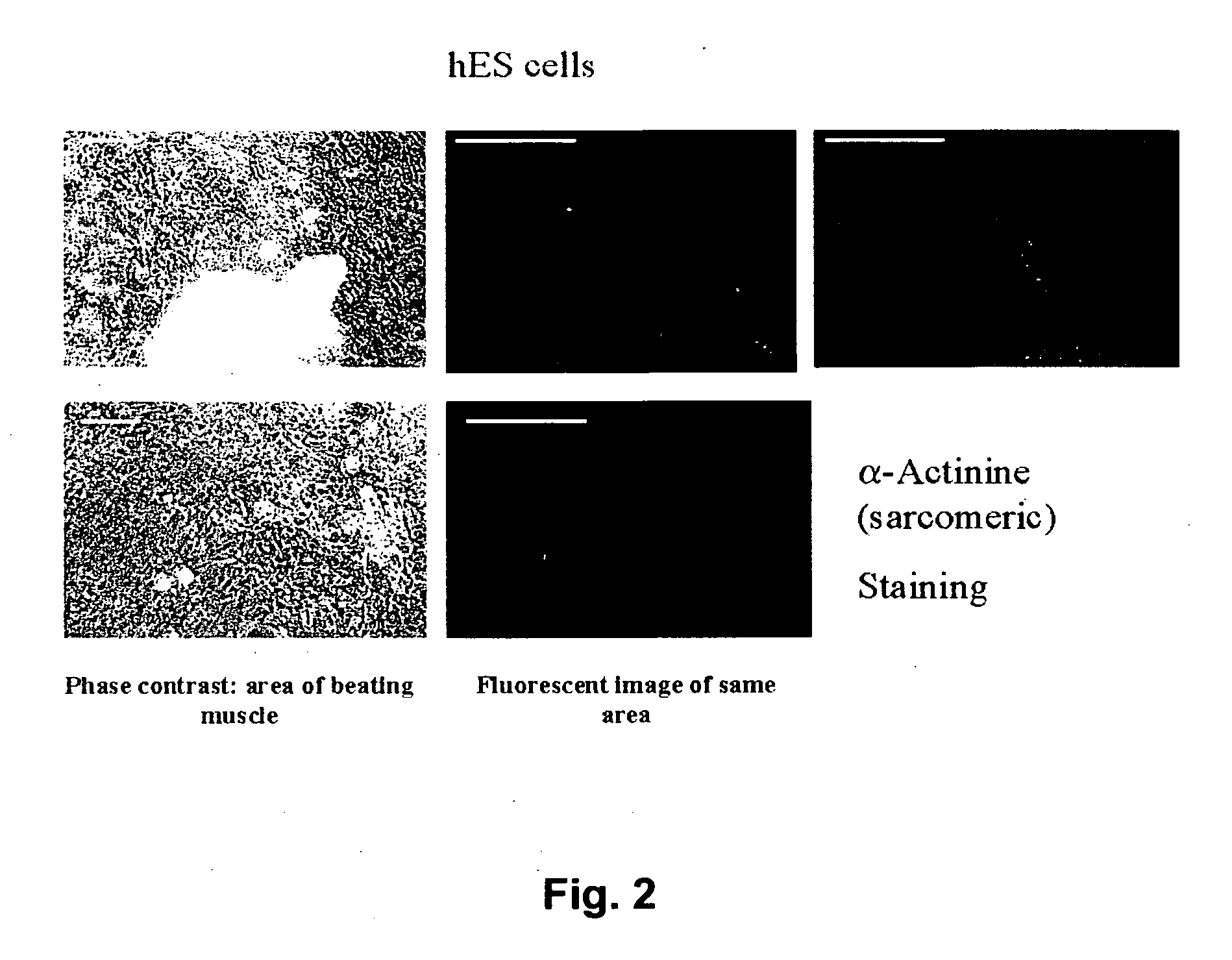Methods of inducing differentiation of stem cells
