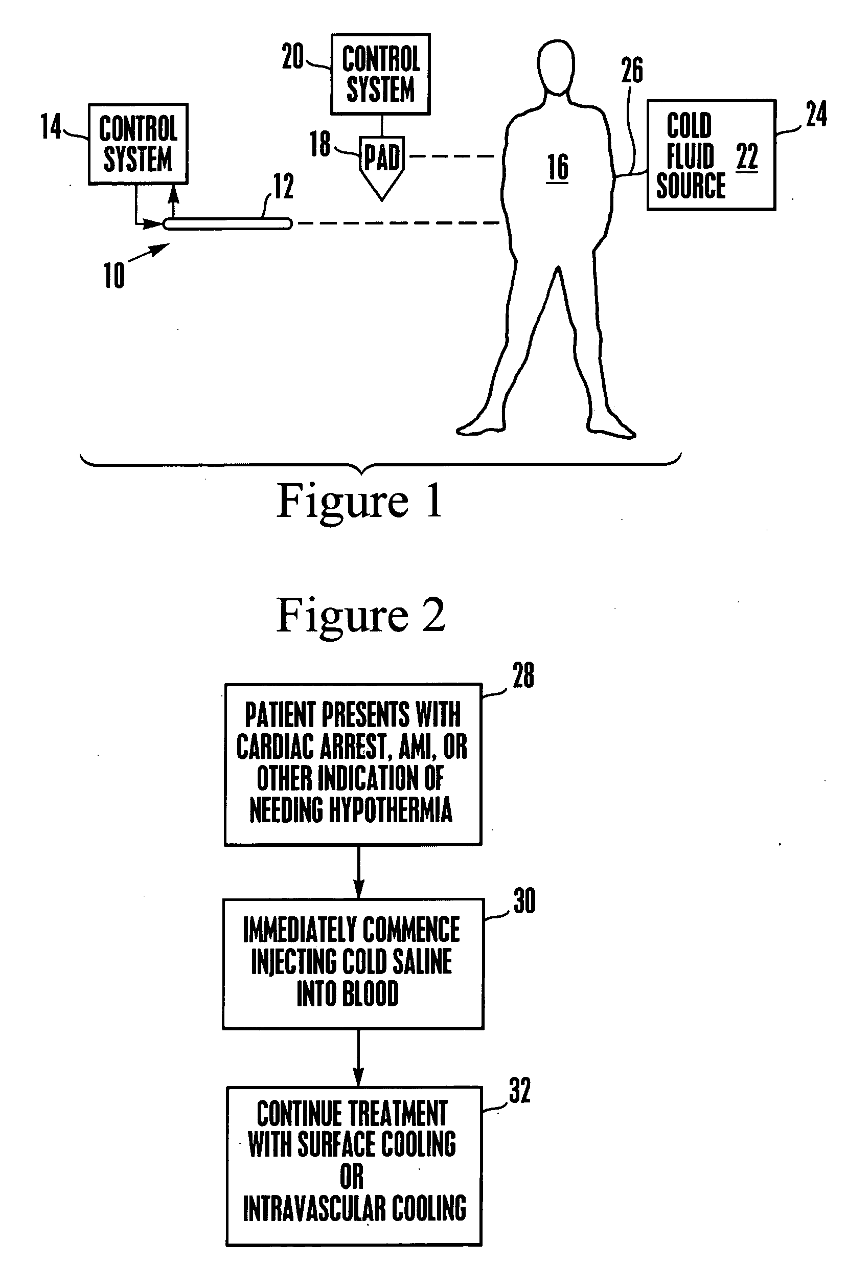 System and method for bringing hypothermia rapidly onboard