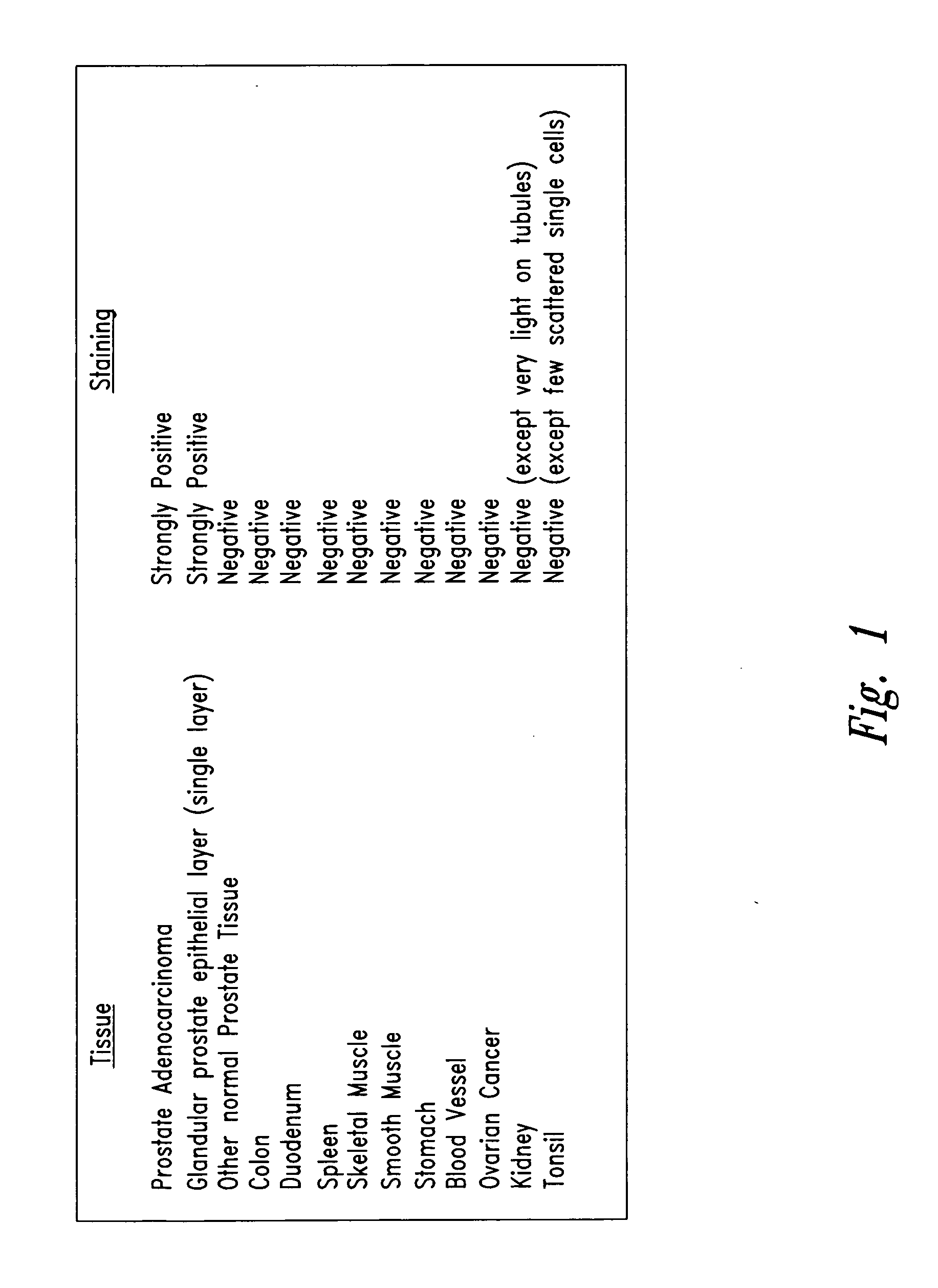 Detection and treatment of prostate cancer