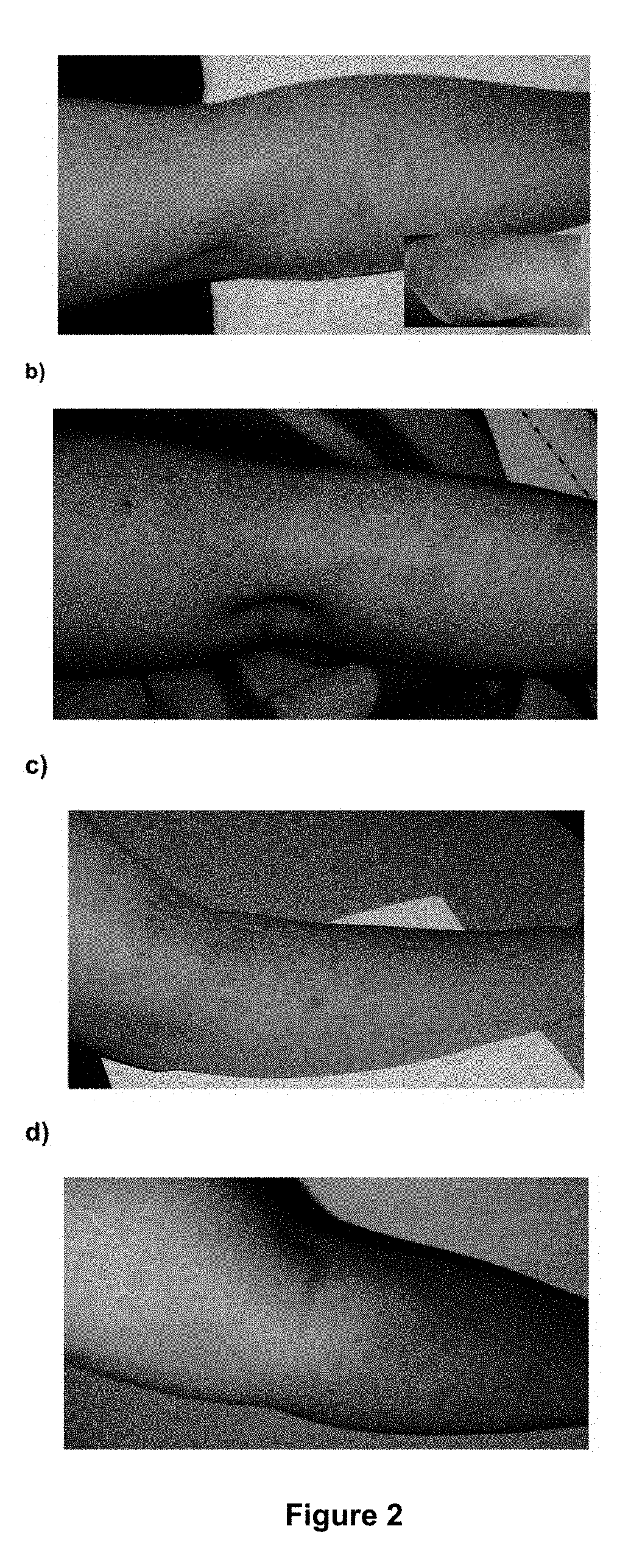 Pharmaceutical composition for preventing, treating, and curing psoriasis including snail slime, chamomile, and honey