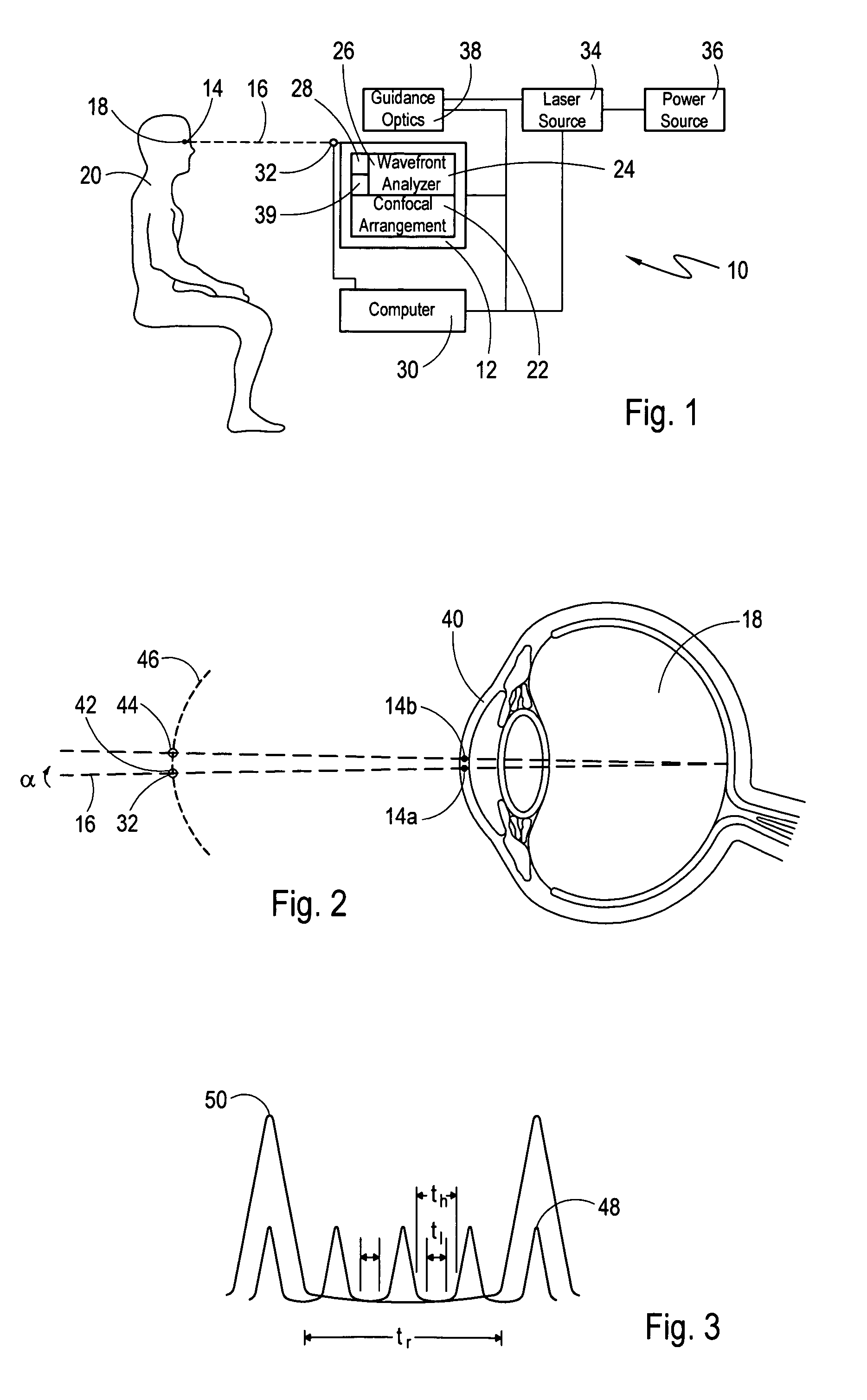 Eye position control monitor for laser vision correction