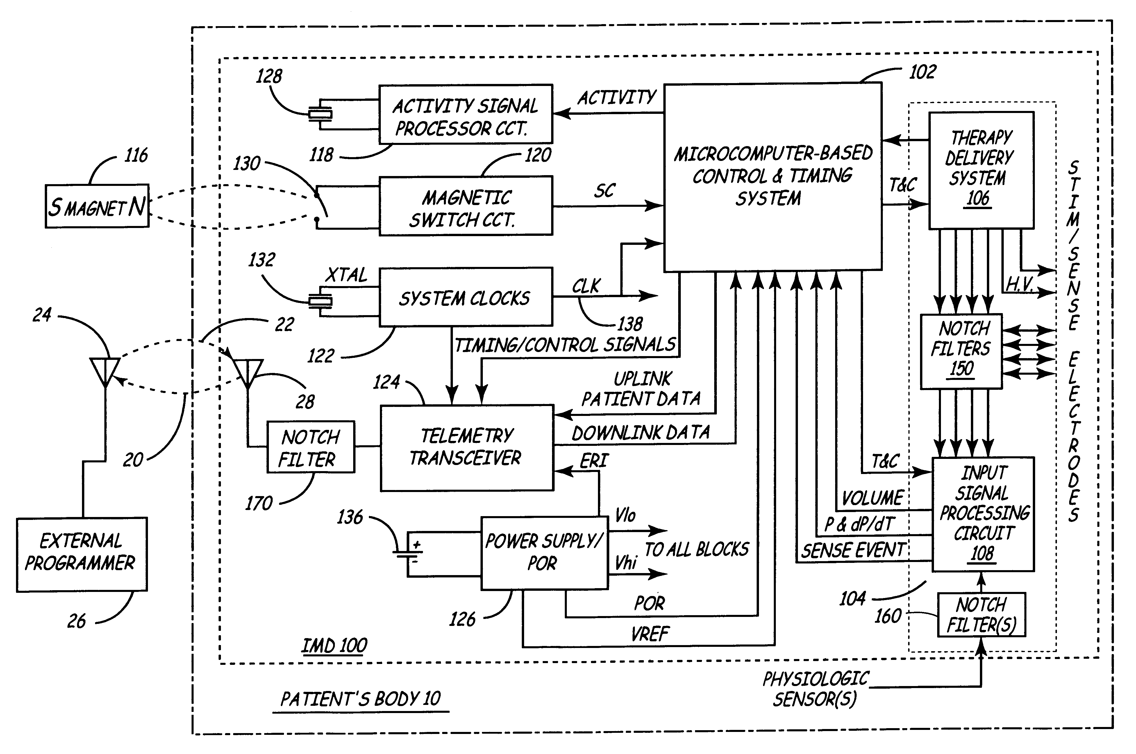 Implantable medical device incorporating integrated circuit notch filters
