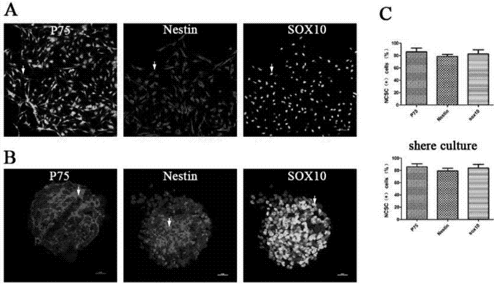 Method for isolating, culturing and differentiating neural crest stem cells from DRG (dorsal root ganglion)