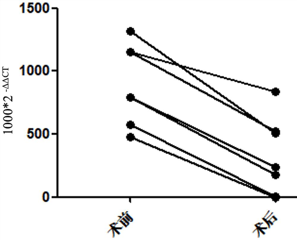 Application of exosomal mRNA in the diagnosis of breast diseases