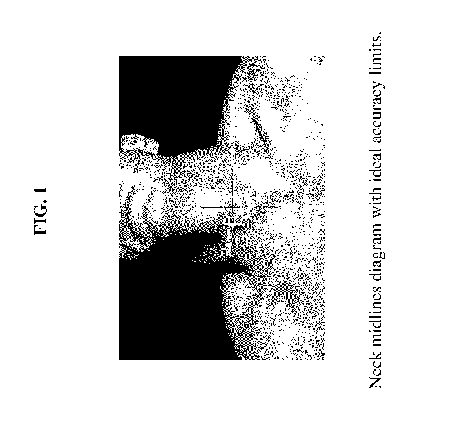 Device for the Mechanical Detection of Underlying Tissues