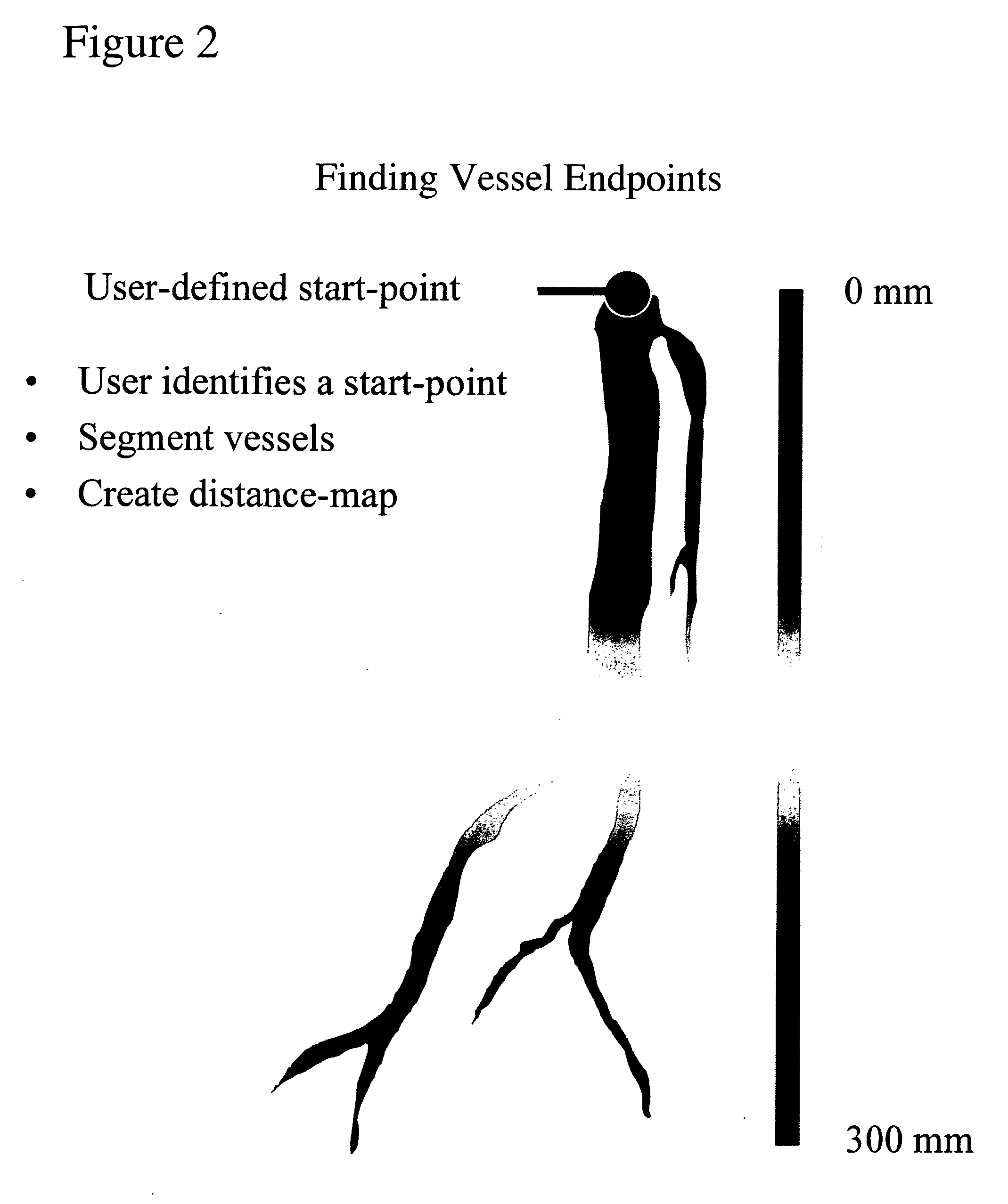 Method to identify arterial and venous vessels