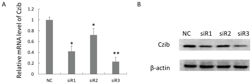 Application of reagent for down-regulating Czib gene expression in preparation of medicine for treating or improving pulmonary fibrosis