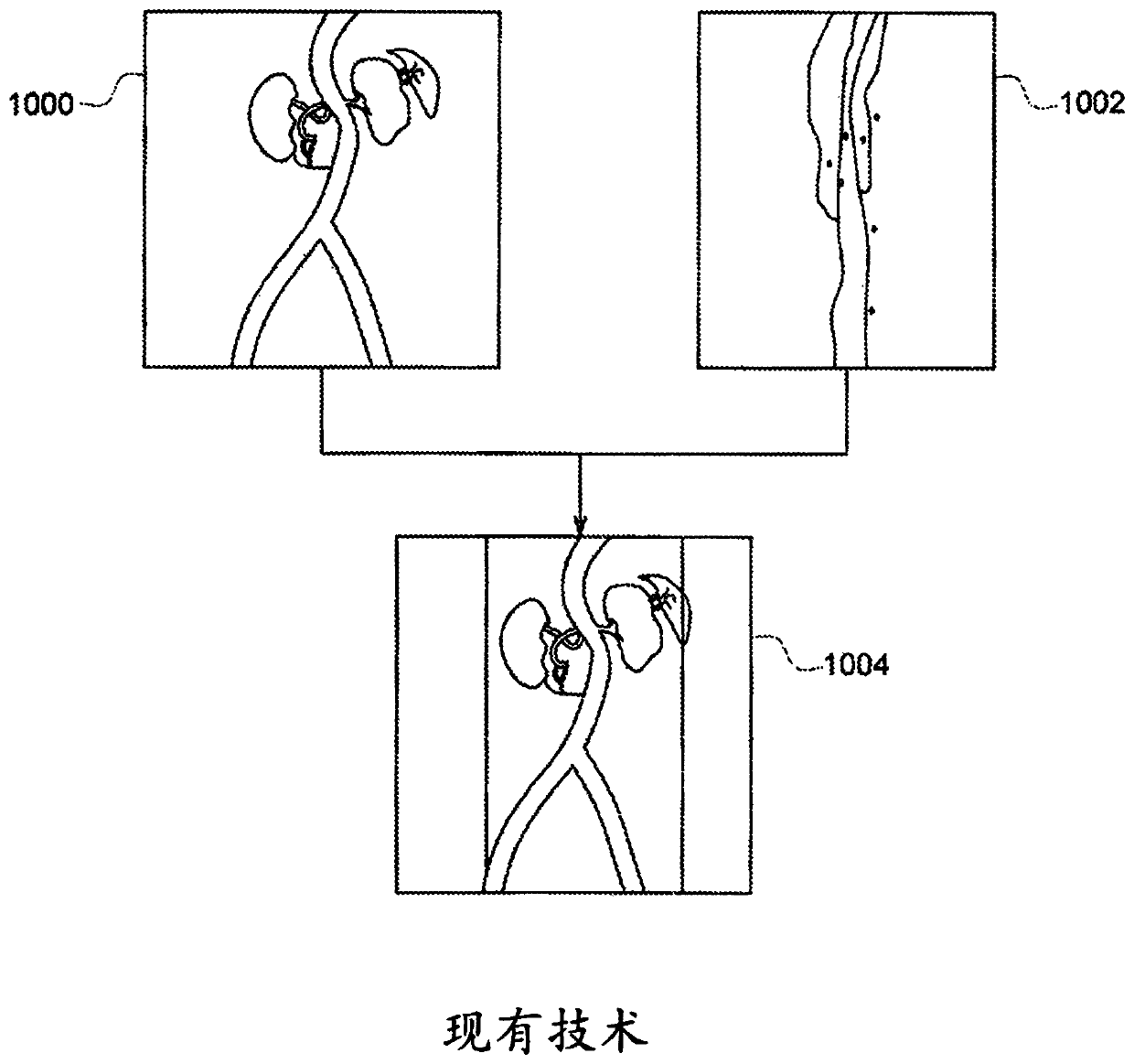 Combination of 3D ultrasound and computed tomography for guidance in interventional medical procedures