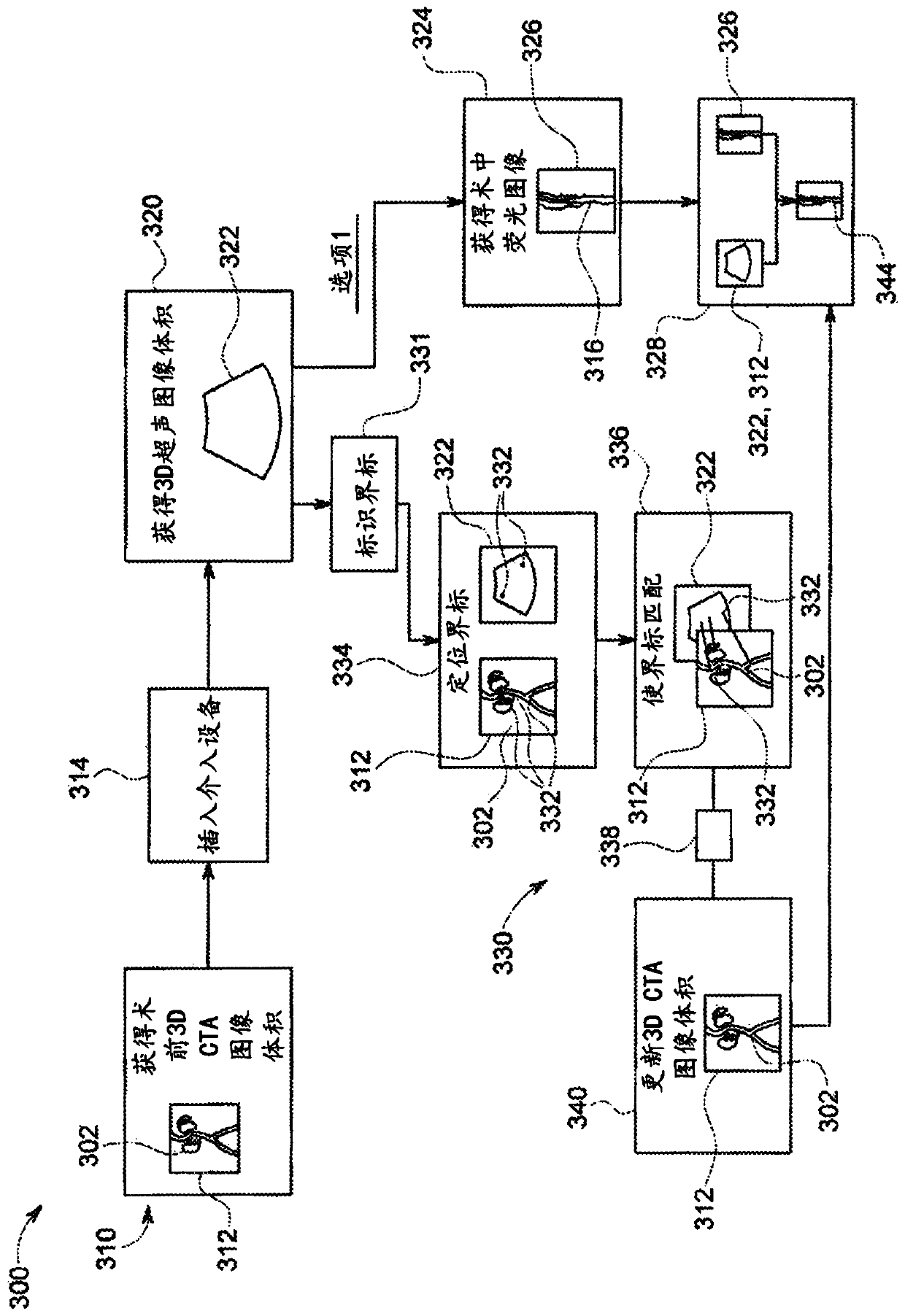 Combination of 3D ultrasound and computed tomography for guidance in interventional medical procedures