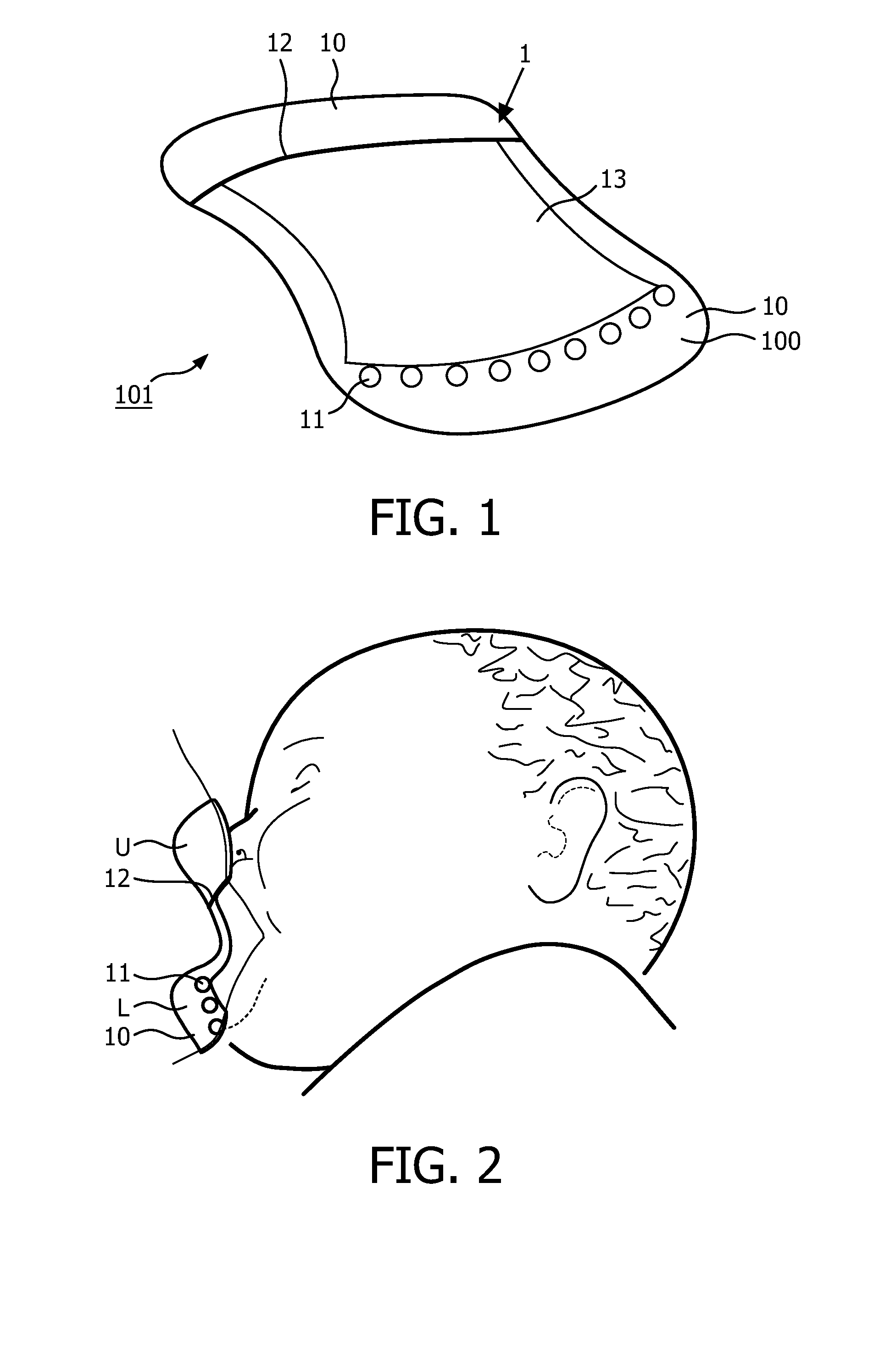 Device and method for guiding latch-on