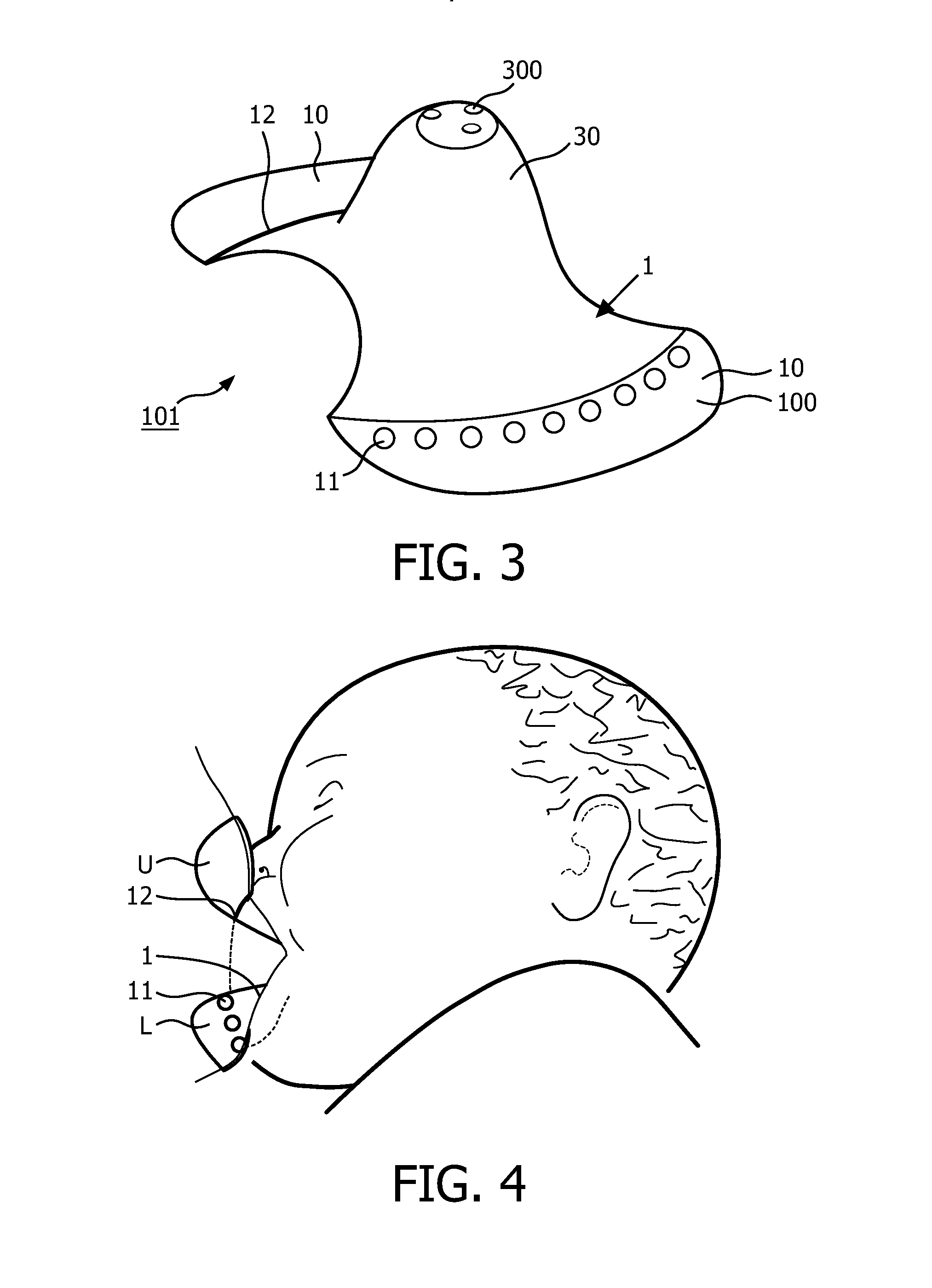 Device and method for guiding latch-on