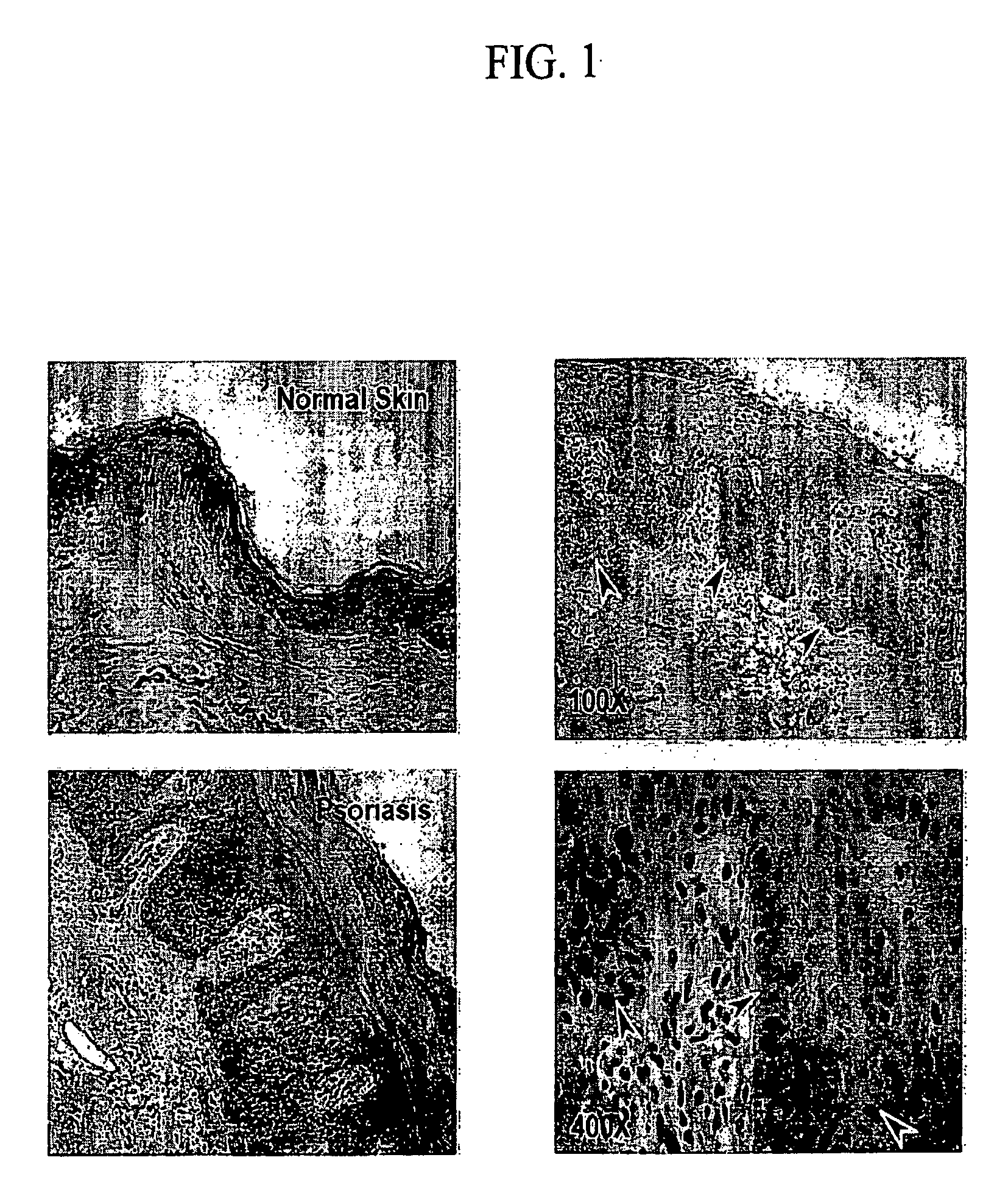 Method for detecting and treating skin disorders