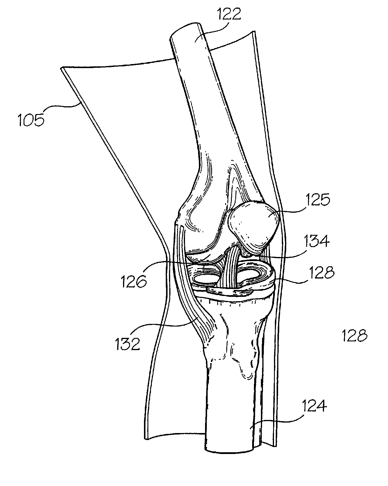 Joint Replica Models and Methods of Using Same for Testing Medical Devices