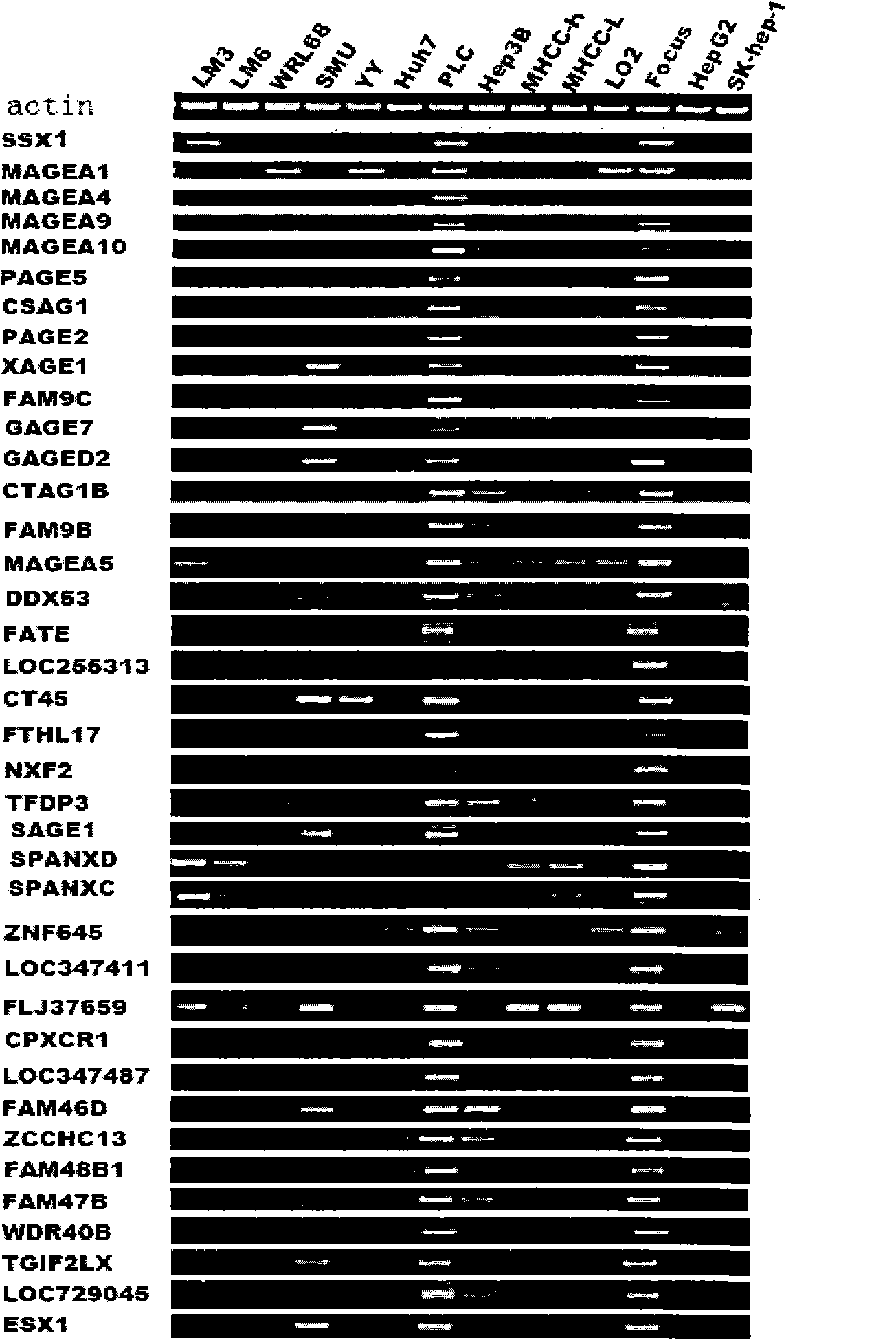 Uses of CXorf41 gene
