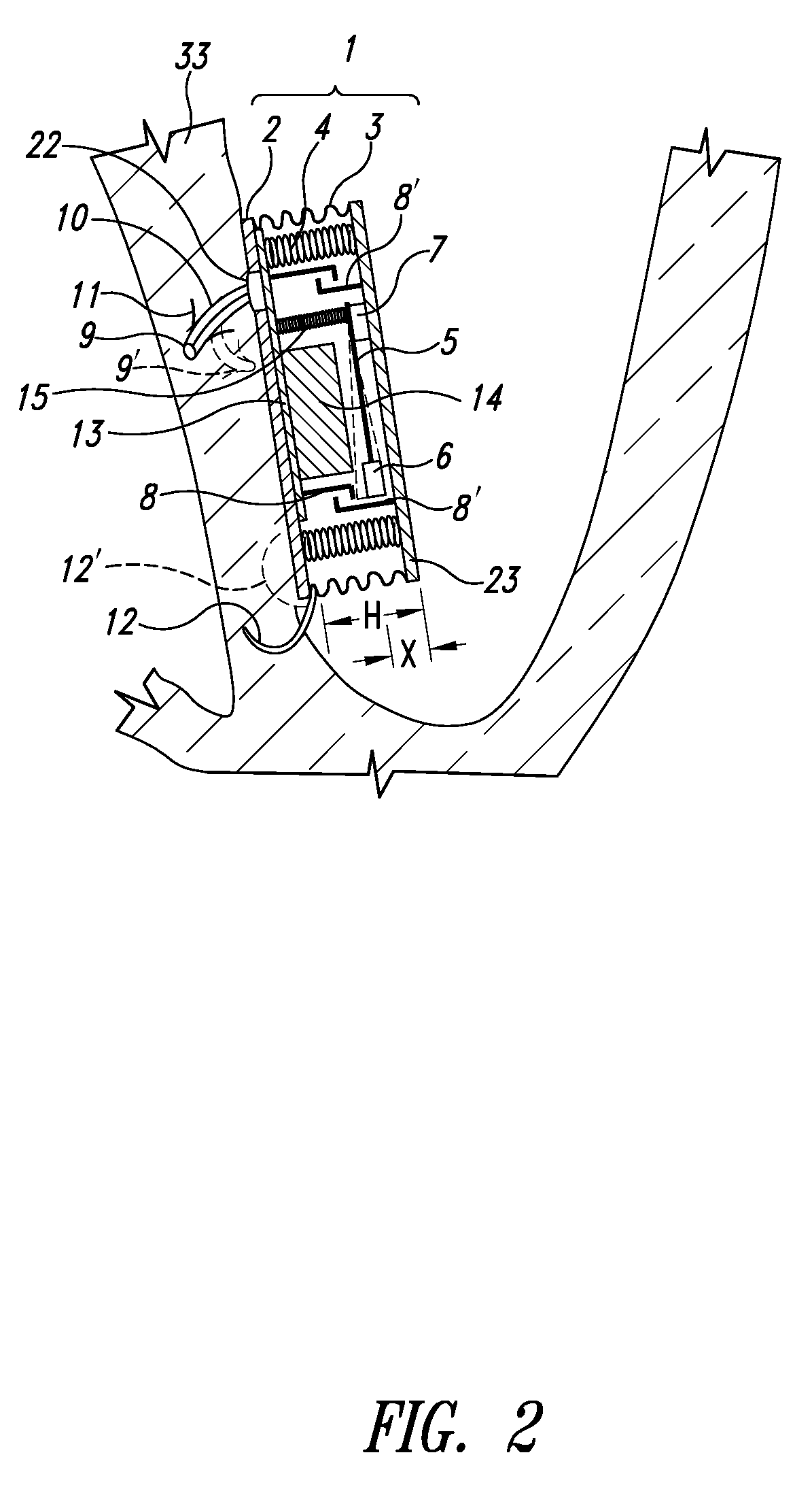 Self-powered resonant leadless pacemaker