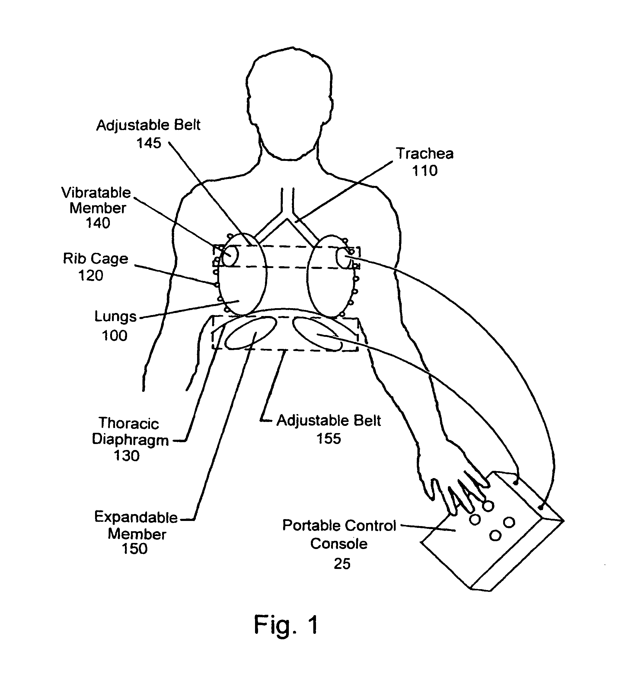 Apparatus for clearing mucus from the pulmonary system