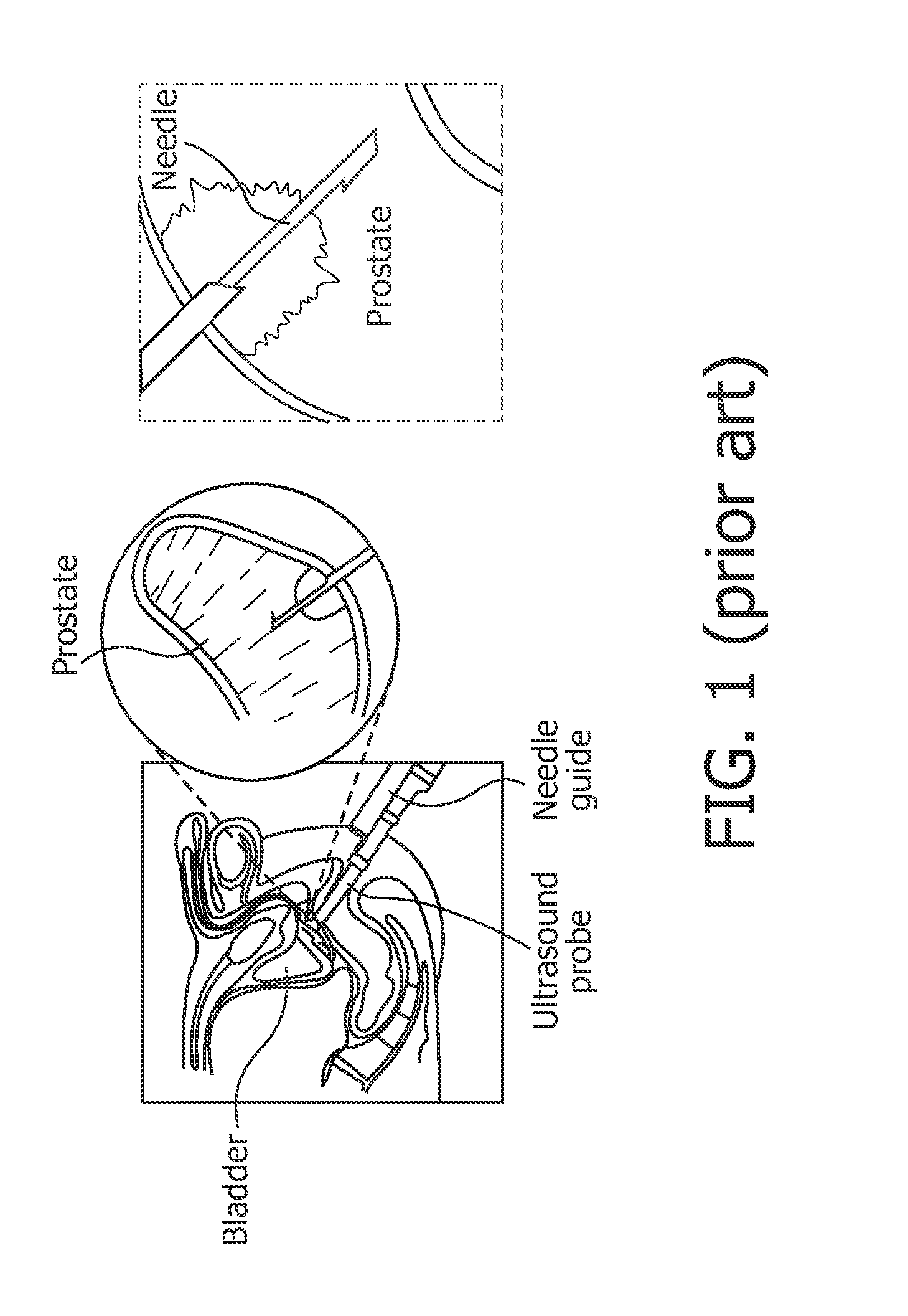 Optical probe having a position measuring system