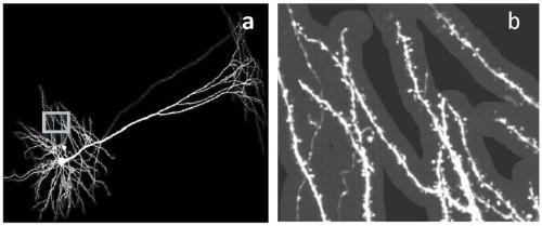 Method and system for automatically detecting single neuron dendritic spine in fluorescence image