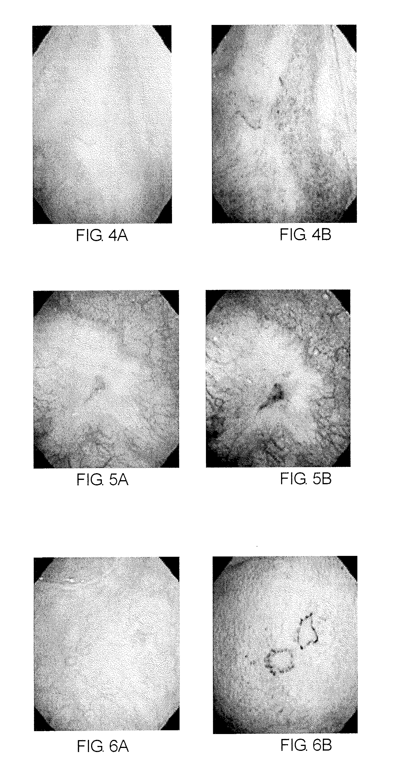 Method of diagnosing a lower urinary tract disorder