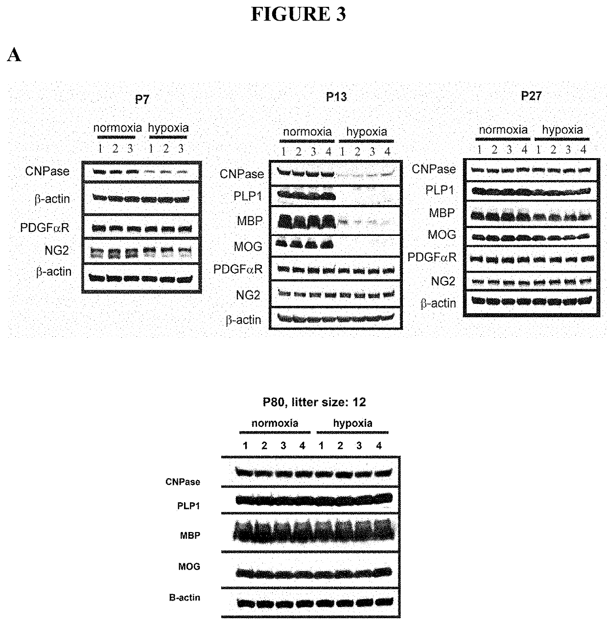 Treatment of neonatal hypoxia including impairments or effects thereof