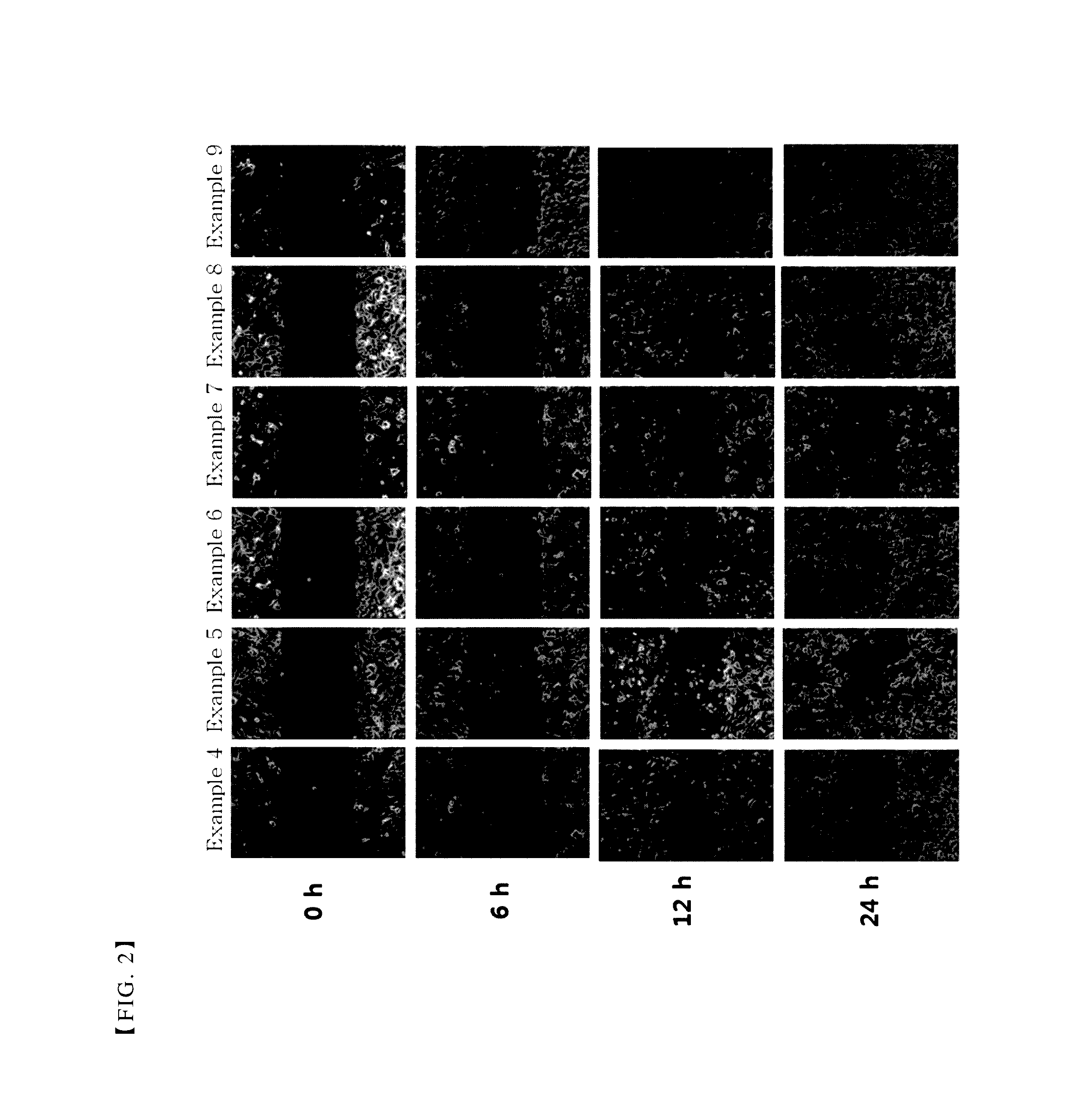 Pharmaceutical composition for treating or preventing corneal wound comprising thymosin beta 4 and citric acid