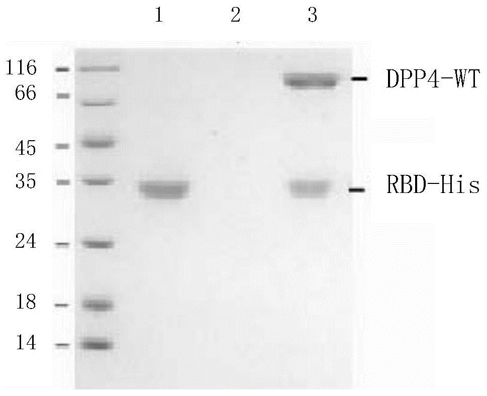 RBD (receptor binding domain) segment in MERS-CoV (Middle East respiratory syndrome coronavirus) membrane protein and coding gene and application thereof