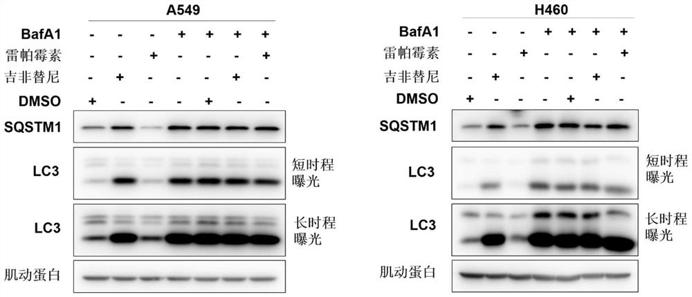 EGFR (epidermal growth factor receptor) kinase inhibitor and application thereof in preparation of anti-cancer drugs