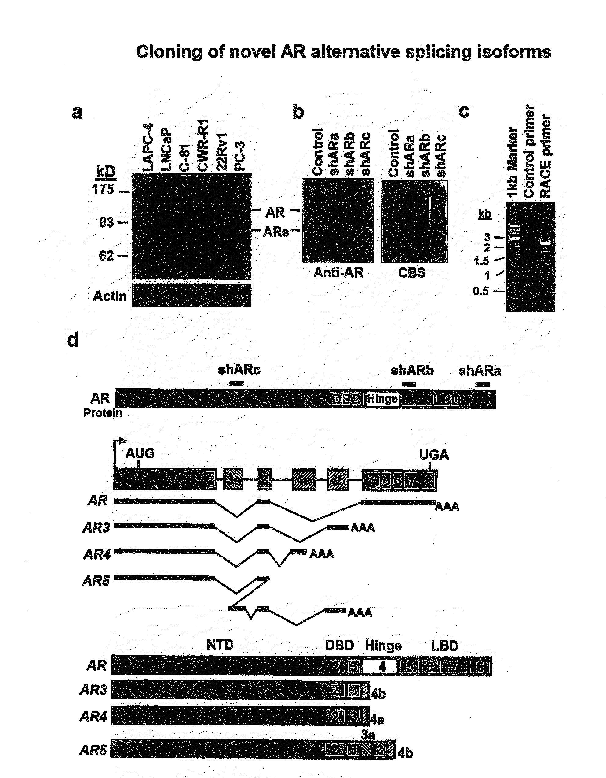 Novel human androgen receptor alternative splice variants as biomarkers and therapeutic targets