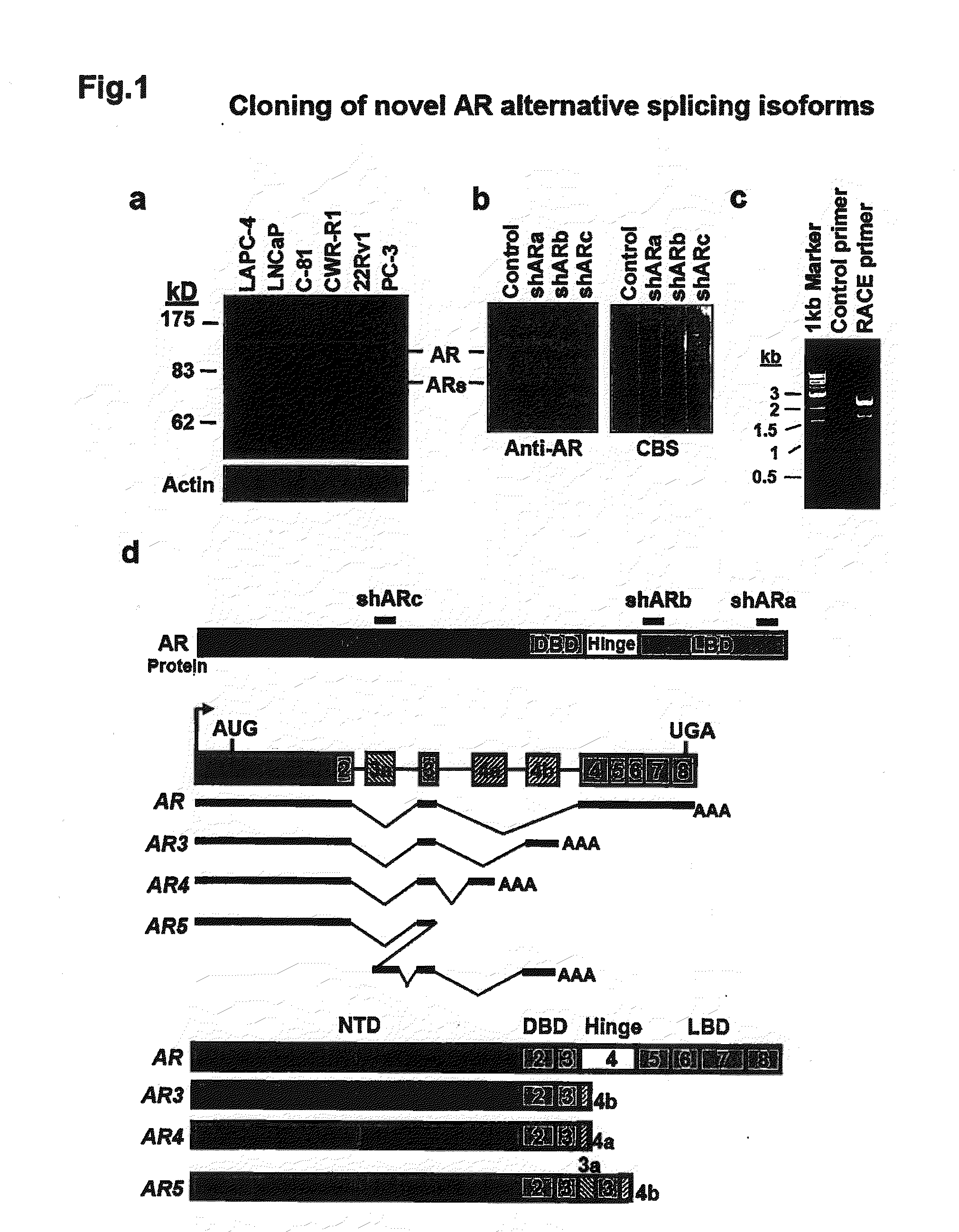 Novel human androgen receptor alternative splice variants as biomarkers and therapeutic targets