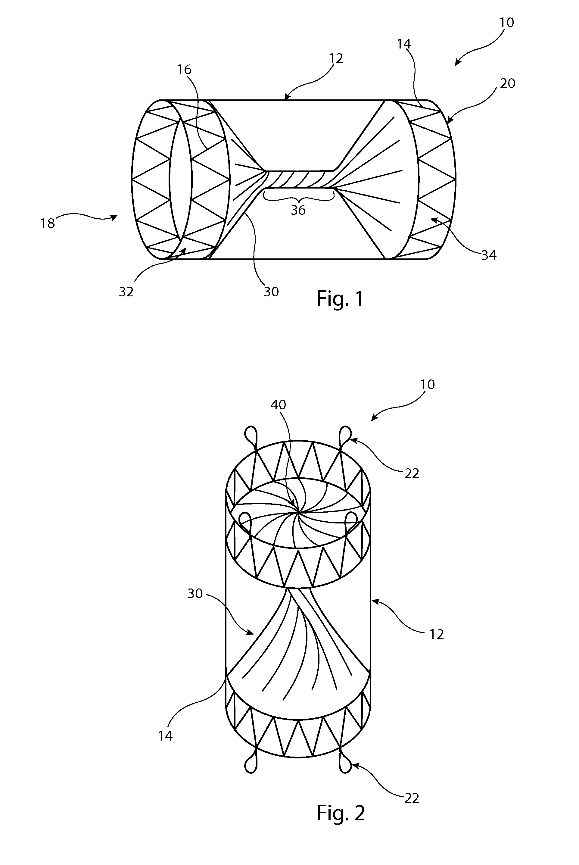 Implantable medical device with twisted element