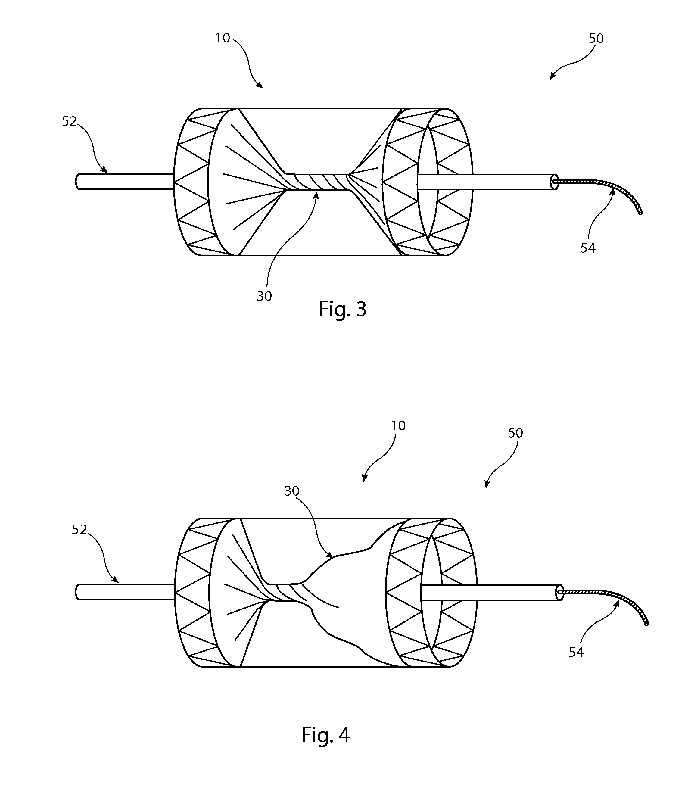 Implantable medical device with twisted element