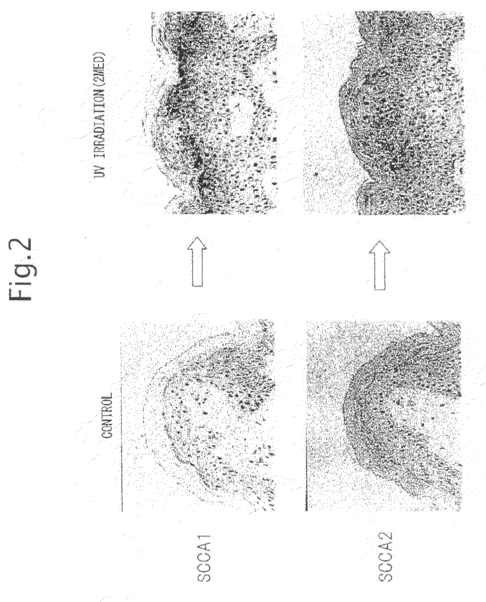 Method and Pharmaceutical Composition for Treating Psoriasis, Squamous Cell Carcinoma and/or Parakeratosis by Inhibiting Expression of Squamous Cell Carcinoma-Related Antigen