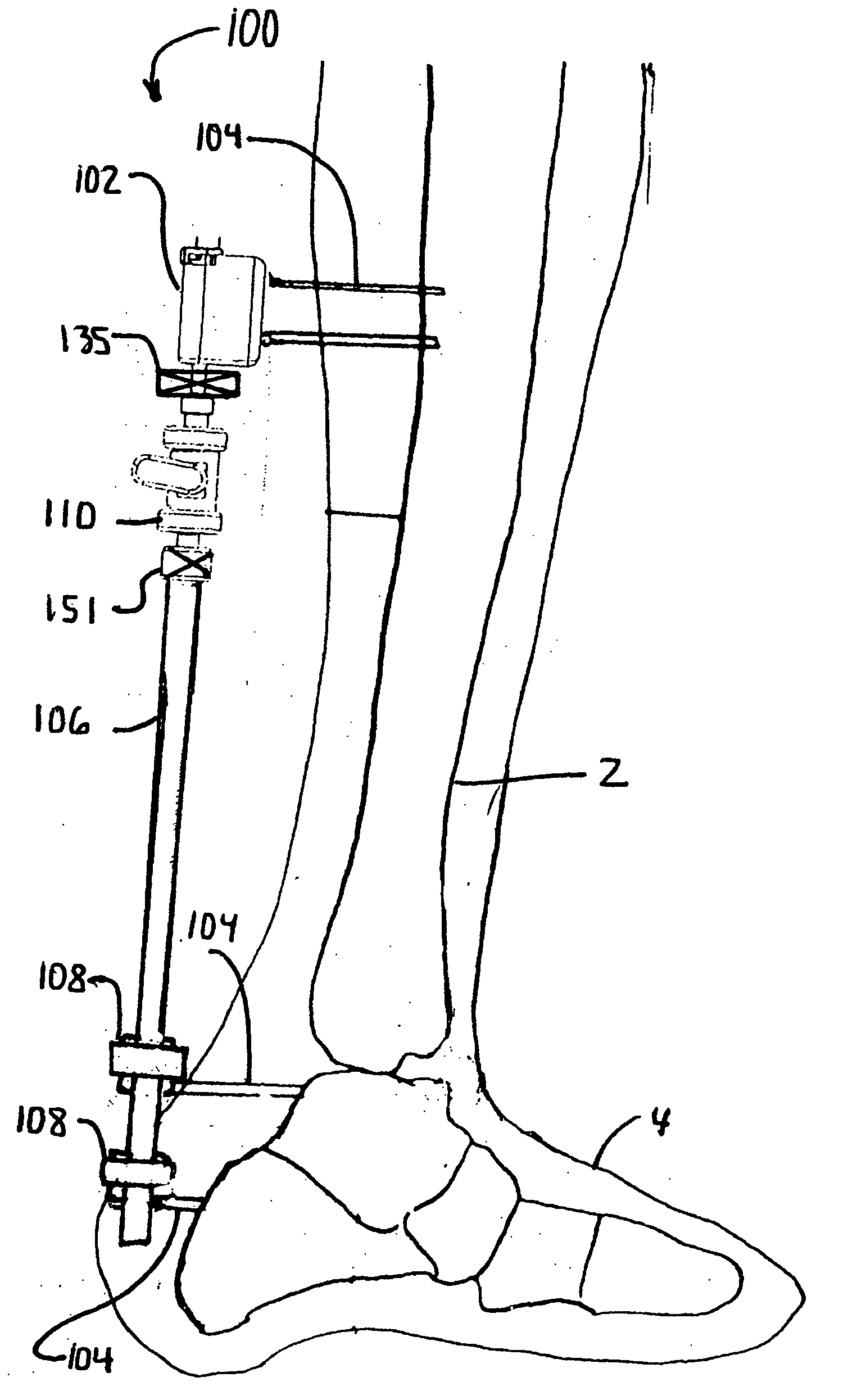 Orthopaedic joint, device and associated method