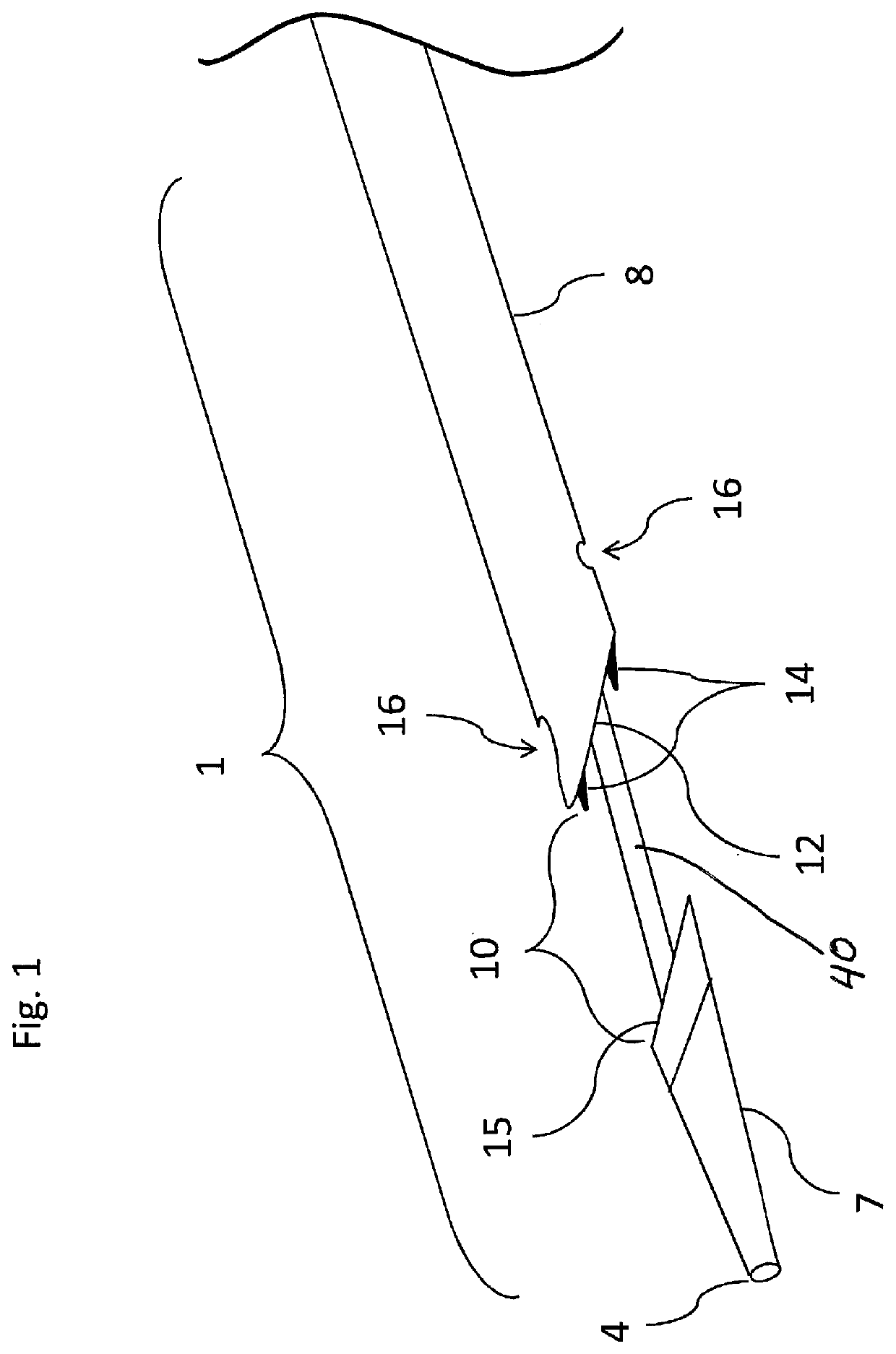 Externally supported anastomosis