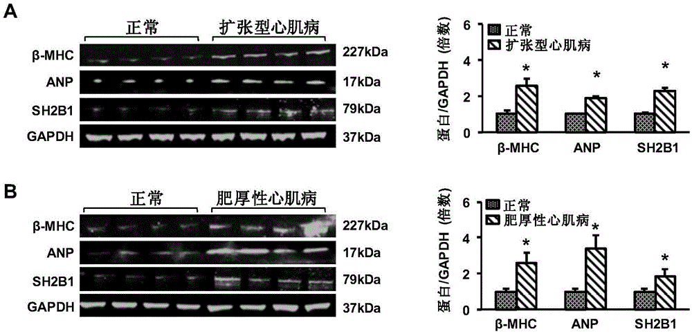 The function and application of sh2b adapter protein 1 (sh2b1) in the treatment of cardiac hypertrophy