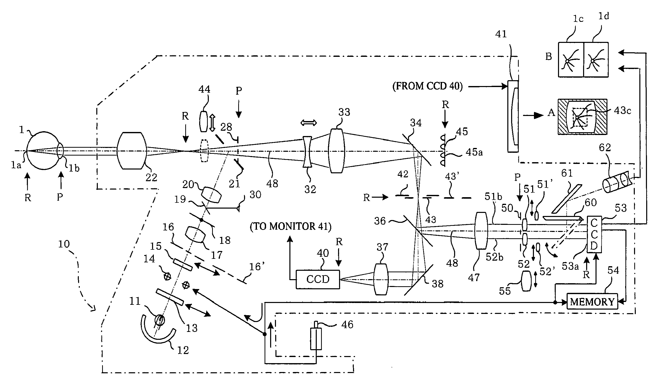 Ophthalmic photography apparatus