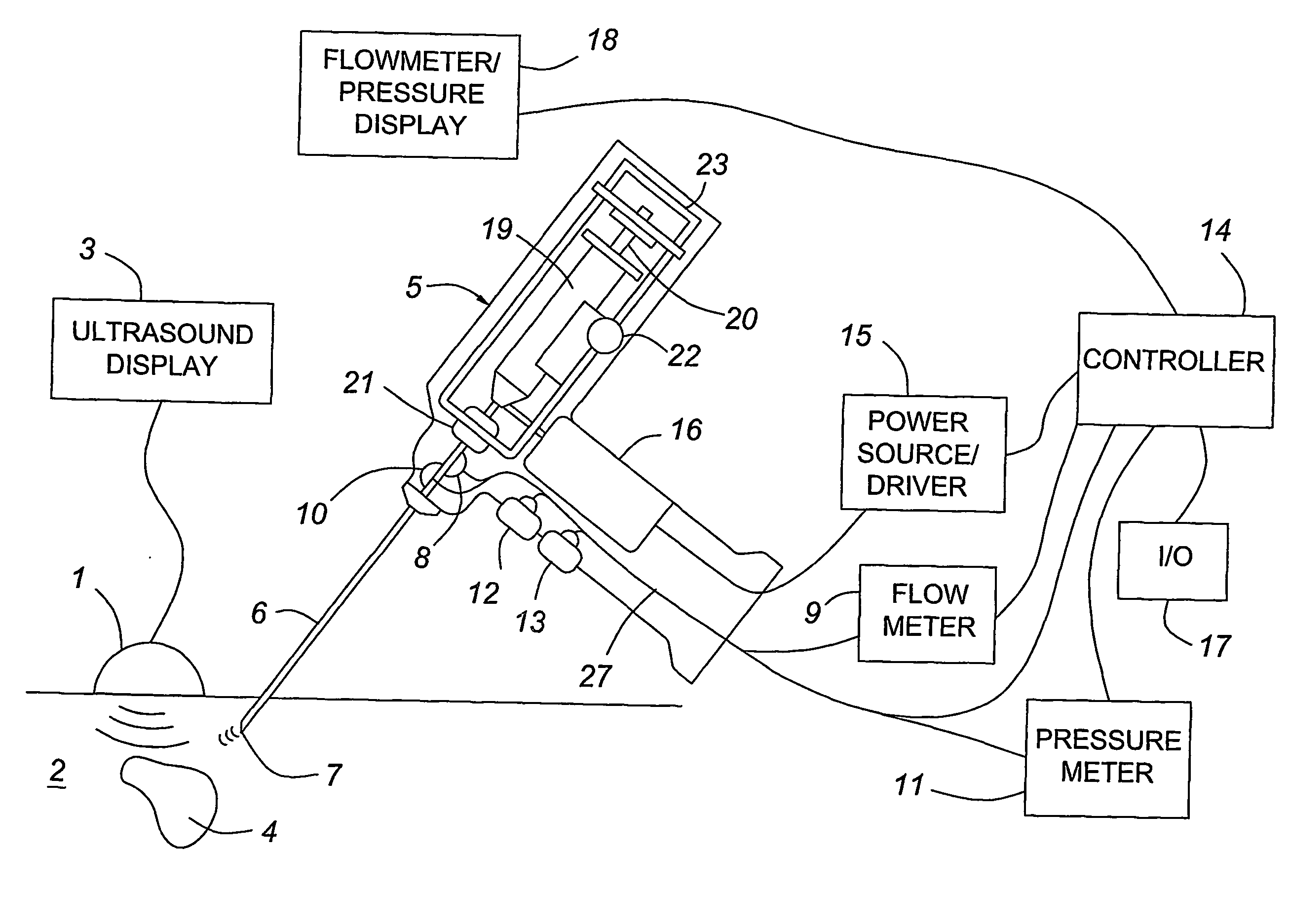 Medical devices with enhanced ultrasonic visibilty