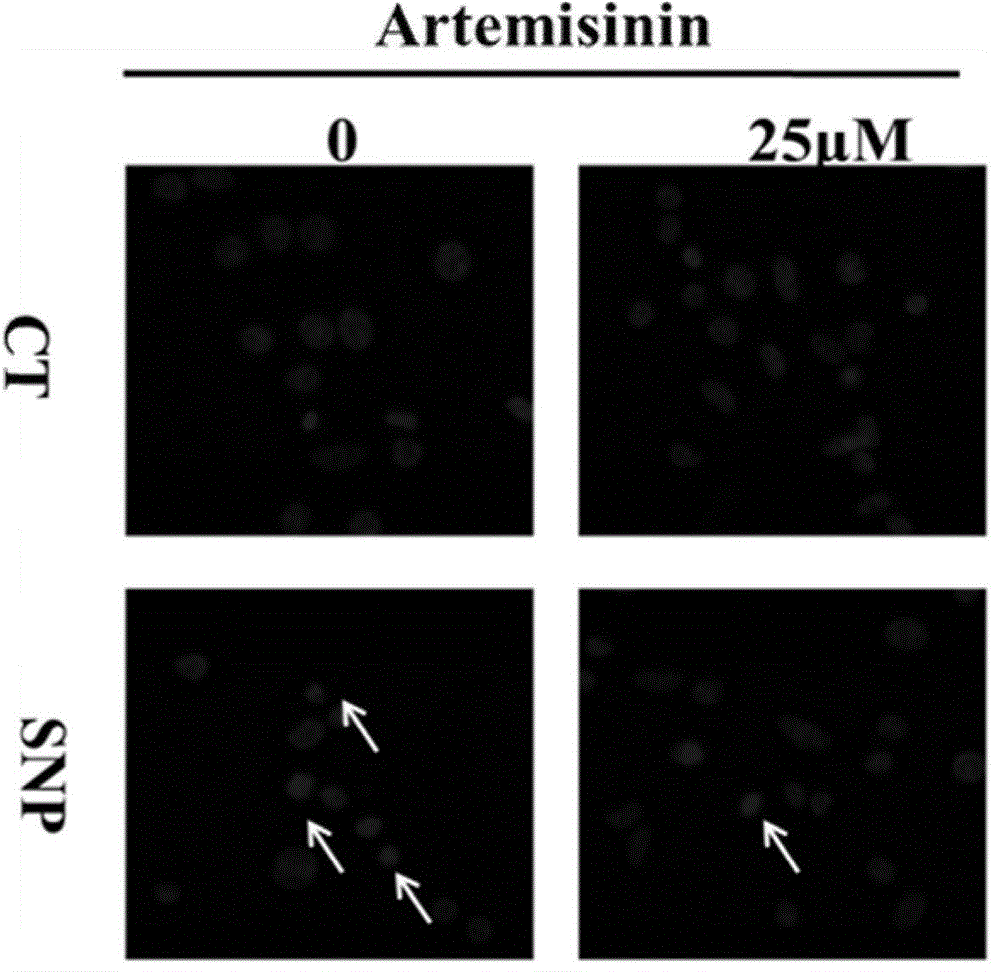 Application of artemisinin in preparing medicament for preventing and treating neurological diseases