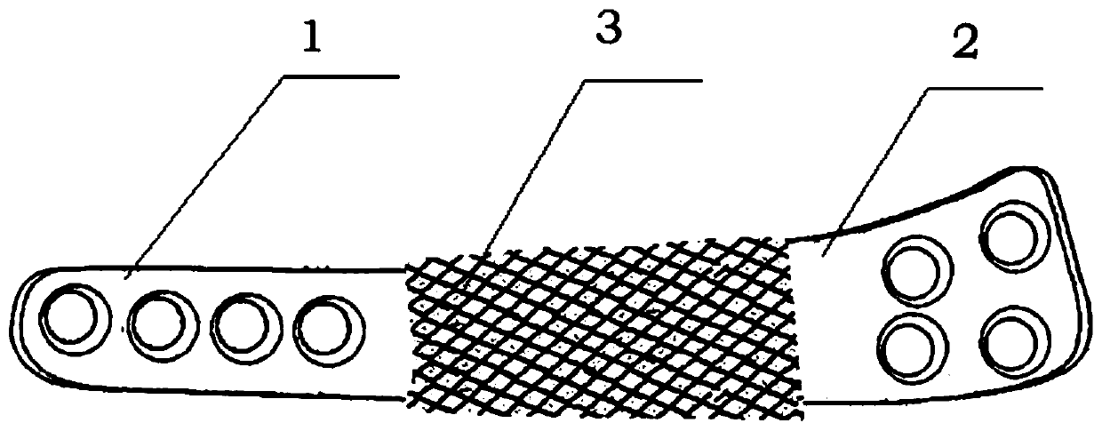 Three-dimensional (3D) printing tubular porous titanium alloy prosthesis for limb large-segment bone defect and preparation method of 3D printing tubular porous titanium alloy prosthesis