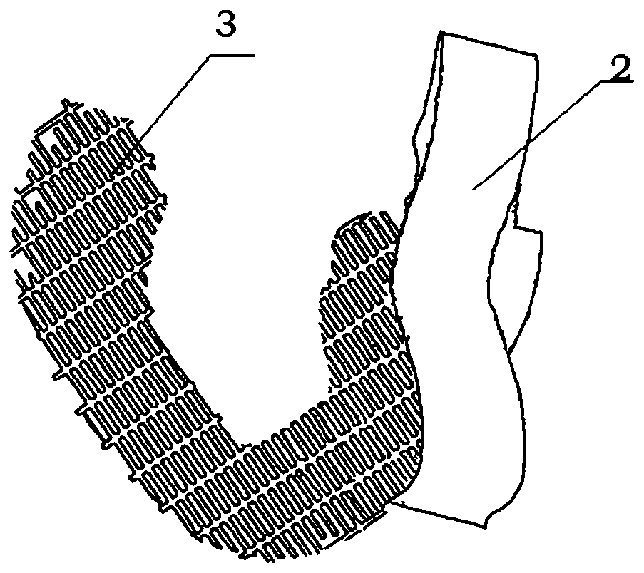 Three-dimensional (3D) printing tubular porous titanium alloy prosthesis for limb large-segment bone defect and preparation method of 3D printing tubular porous titanium alloy prosthesis