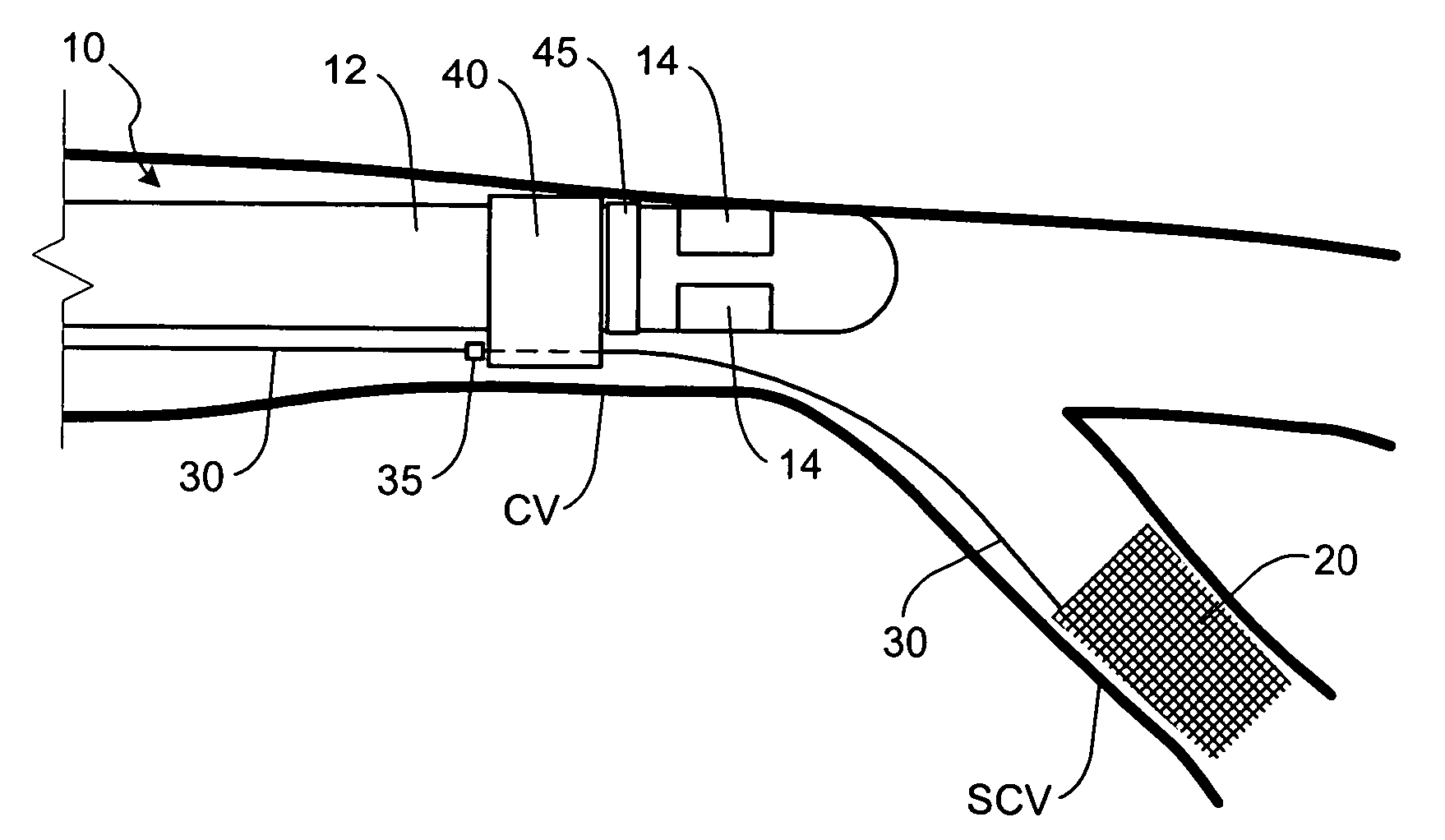 Lead stabilization devices and methods